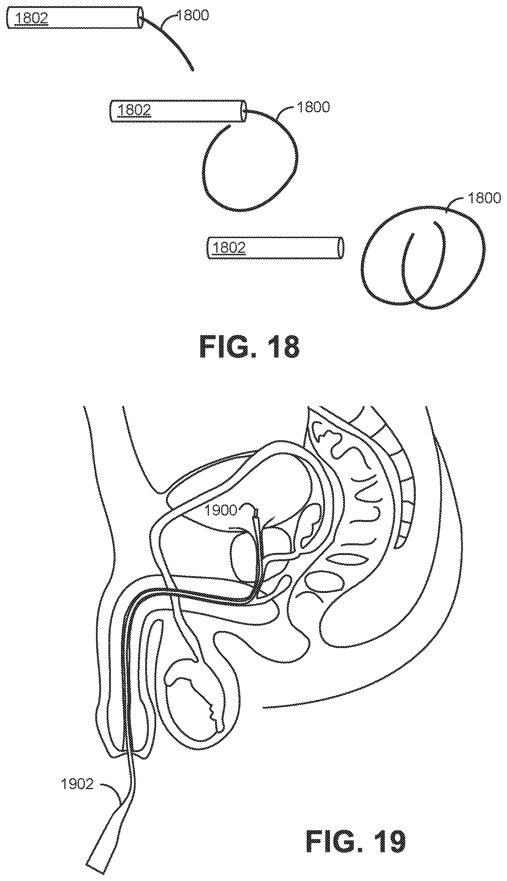Patent US12403086 Figure 8 – Solid drug tablets for implantable drug delivery devices