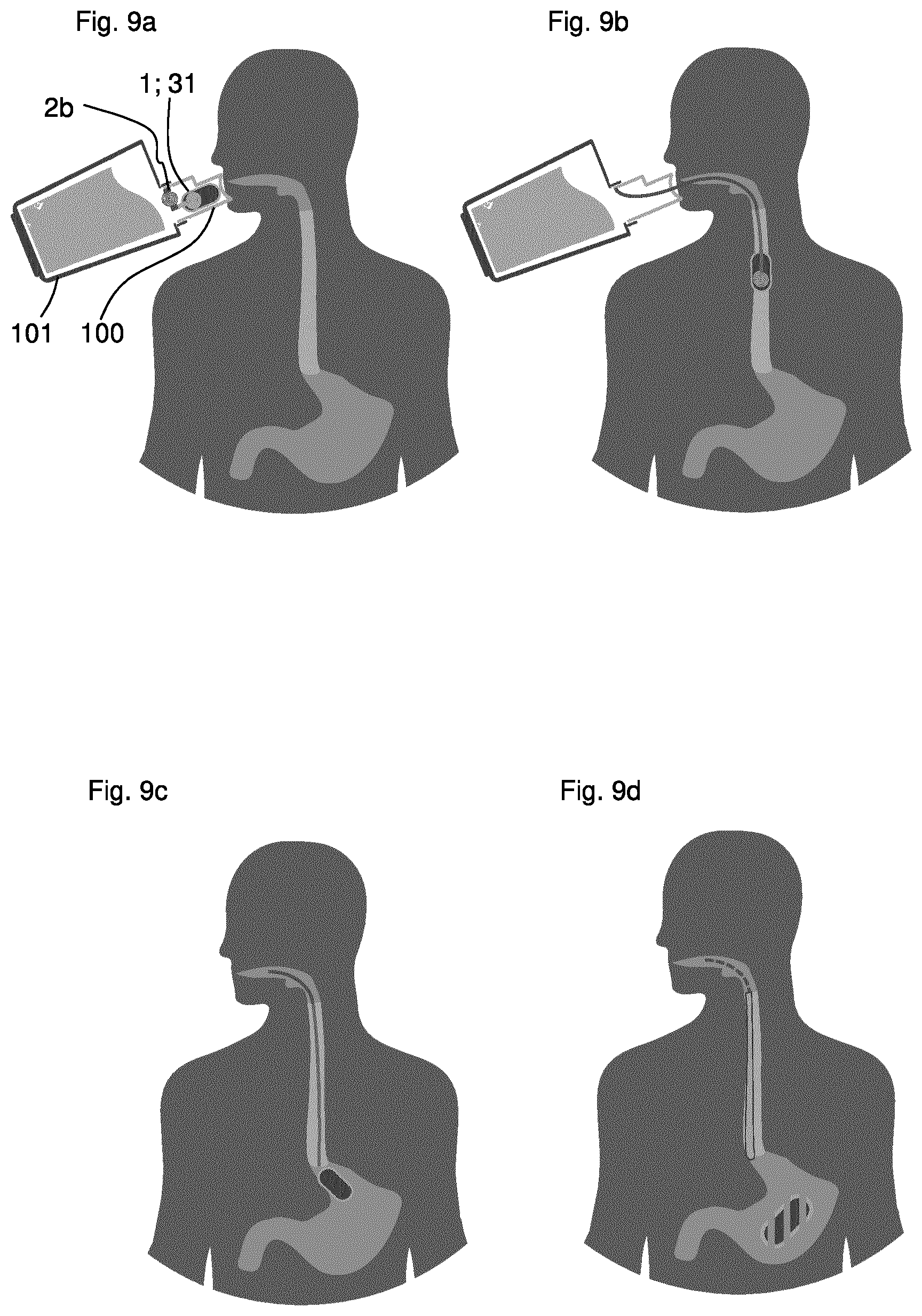 Patent US12403098 Figure 7 – Pharmaceutical dosage form for application to mucous membranes and methods for producing same