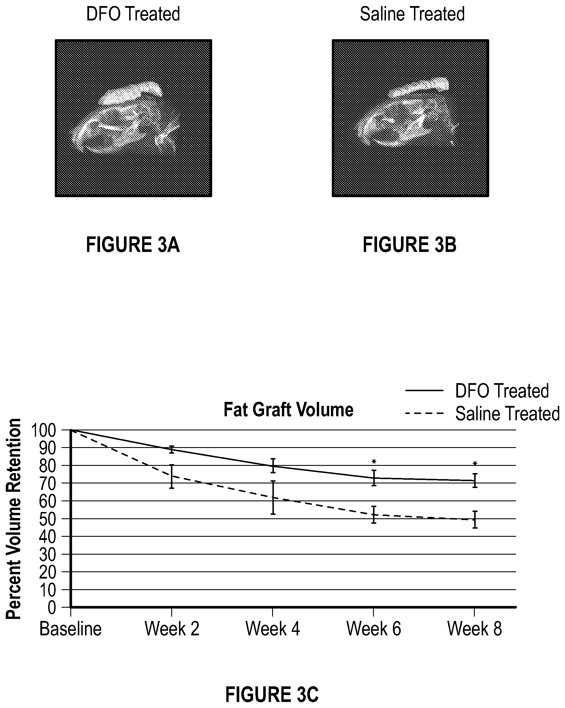 Patent US12403106 Figure 3 – Prophylactic skin treatment for radiation therapy