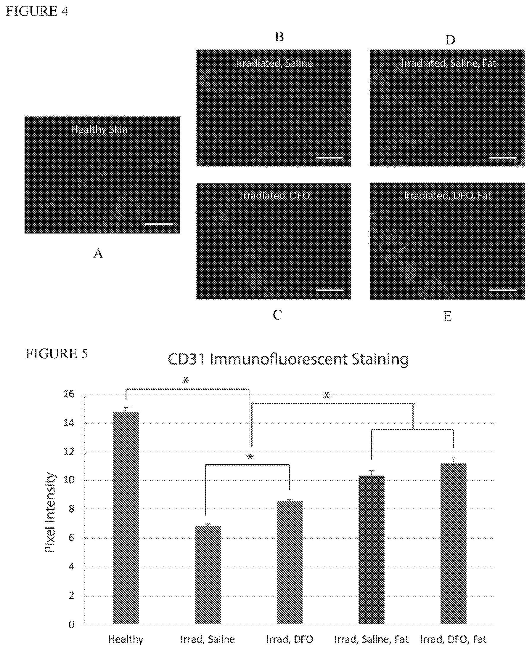 Patent US12403106 Figure 4 – Prophylactic skin treatment for radiation therapy