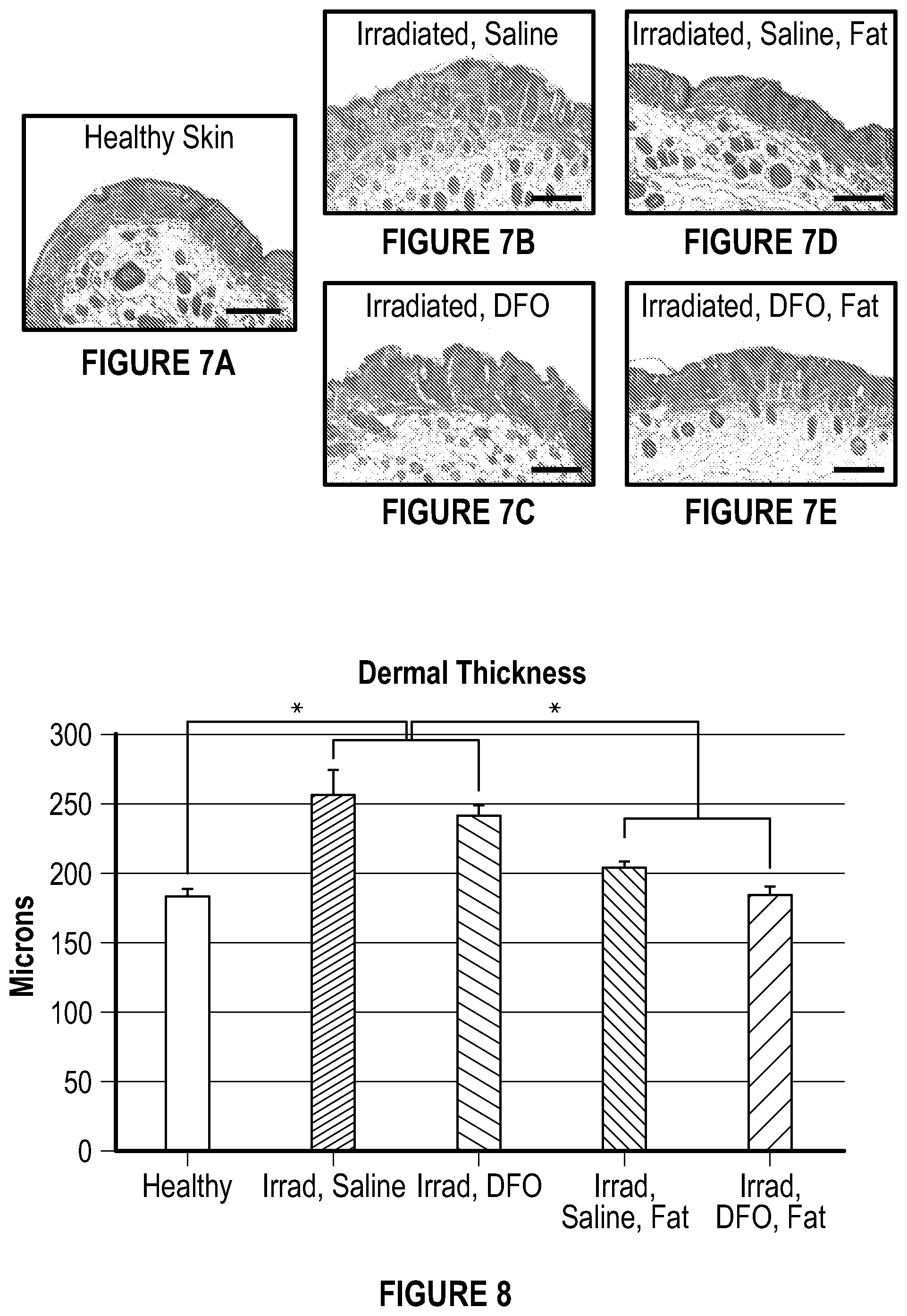 Patent US12403106 Figure 6 – Prophylactic skin treatment for radiation therapy