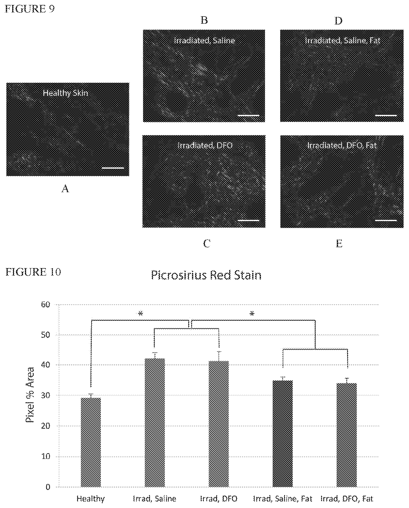 Patent US12403106 Figure 7 – Prophylactic skin treatment for radiation therapy