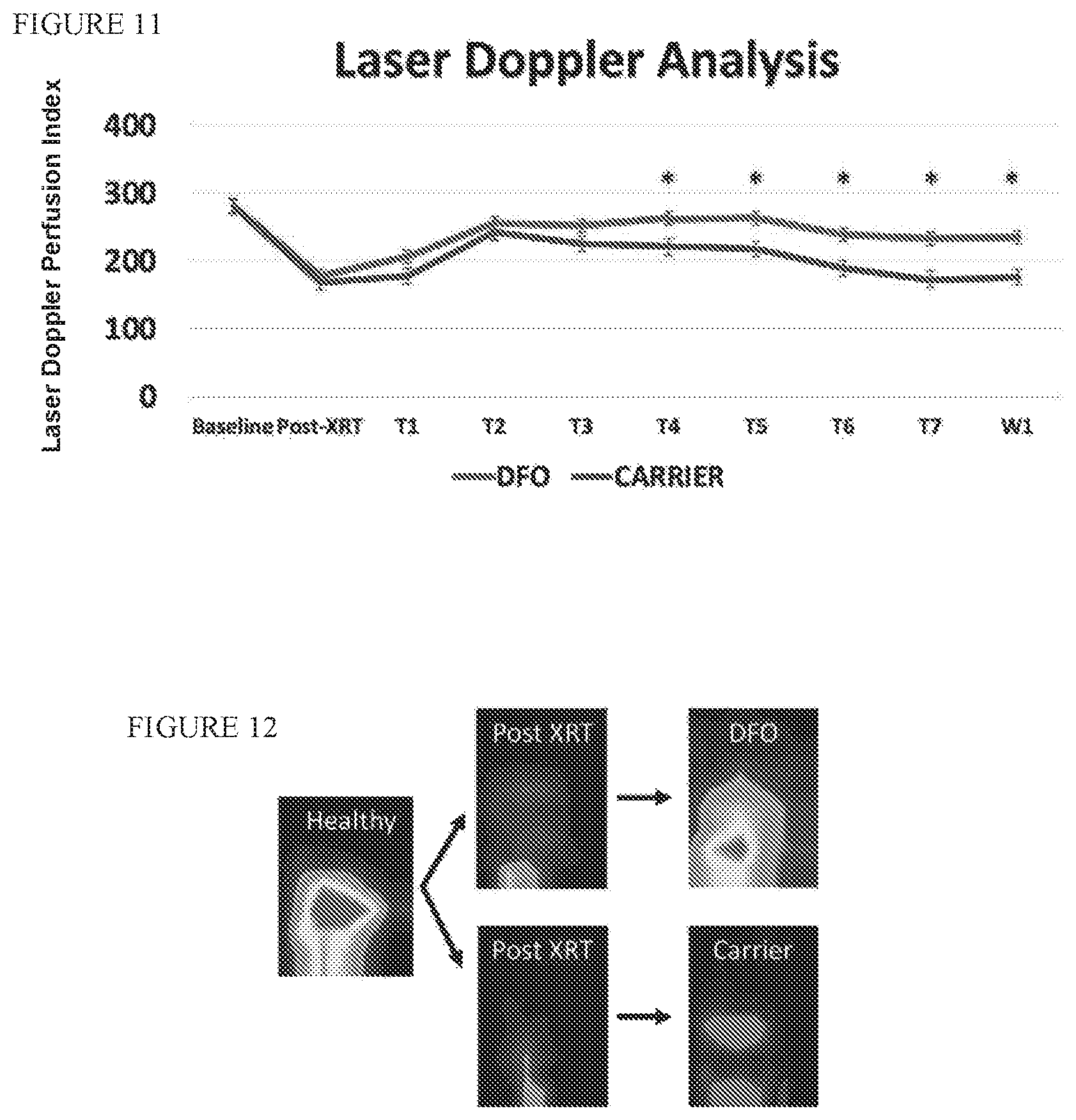 Patent US12403106 Figure 8 – Prophylactic skin treatment for radiation therapy