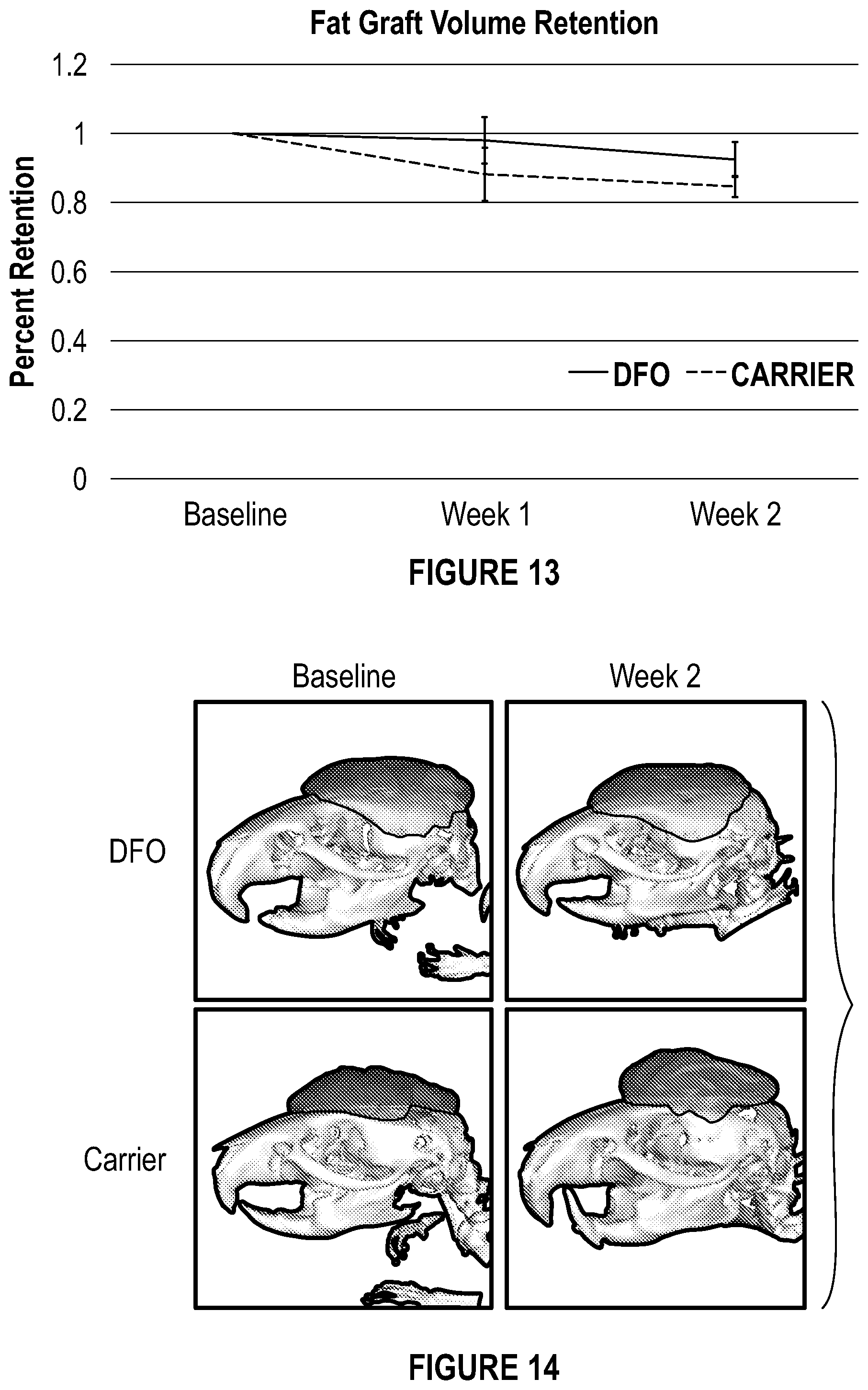 Patent US12403106 Figure 9 – Prophylactic skin treatment for radiation therapy