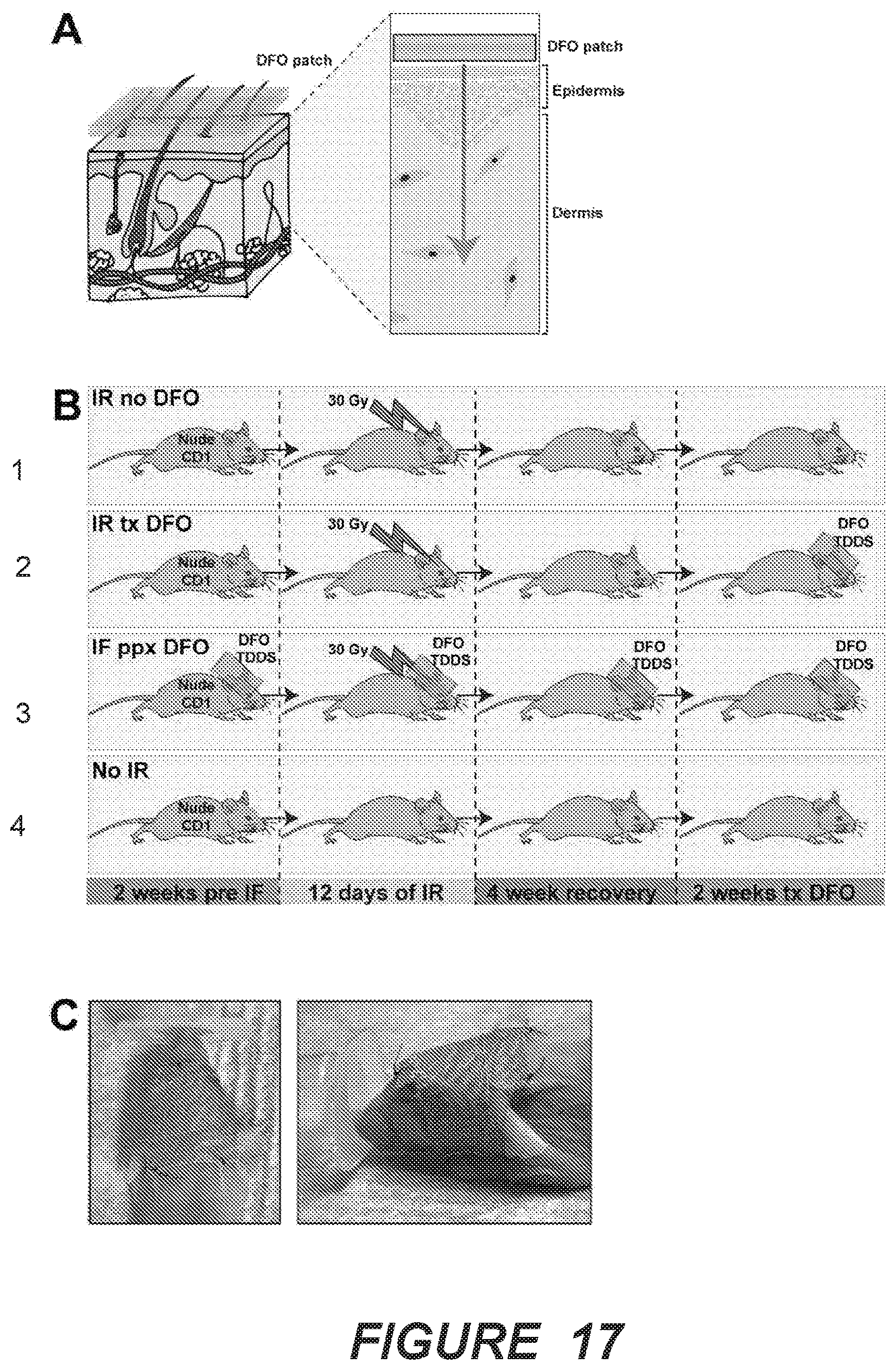 Patent US12403106 Figure 11 – Prophylactic skin treatment for radiation therapy