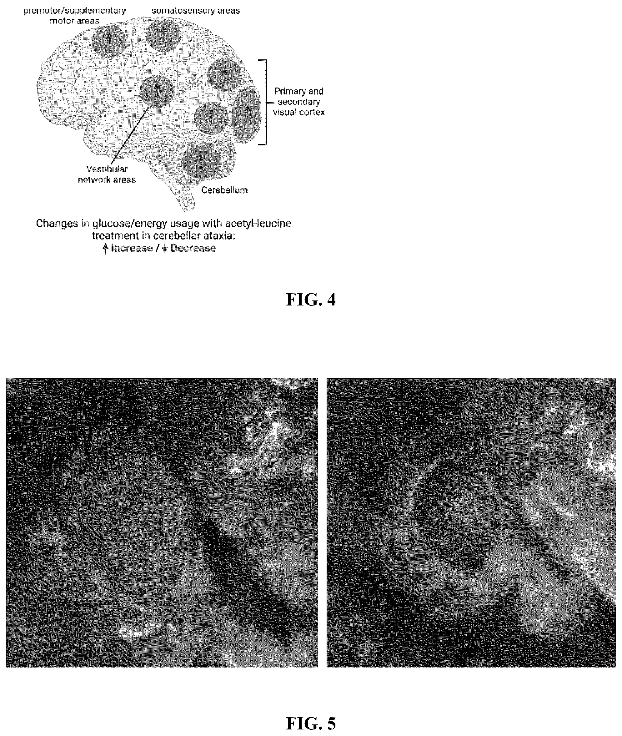 Patent US12403111 Figure 3 – Compositions and methods for treating neurodevelopmental disorders