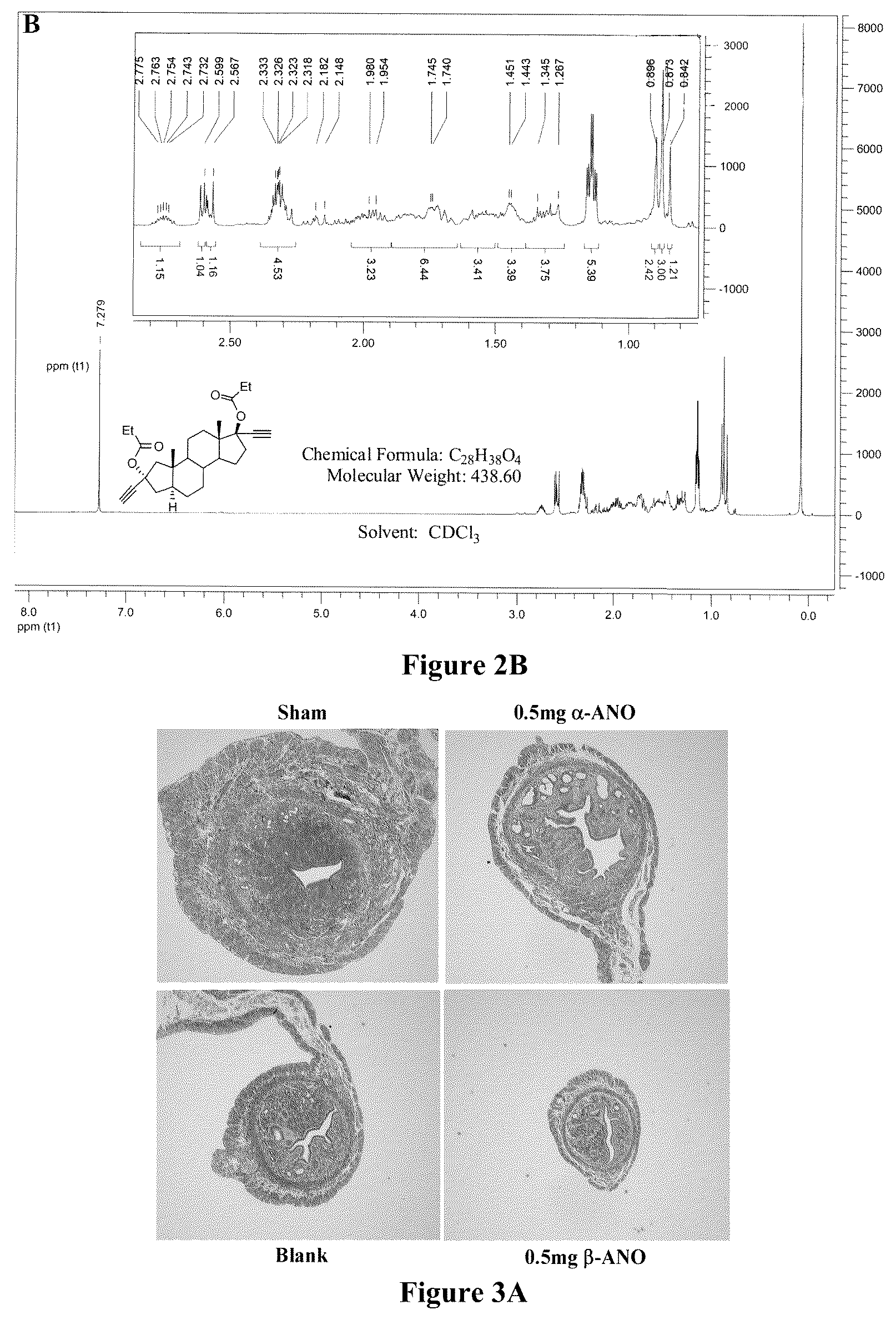 Patent US12403115 Figure 3 – Asymmetric synthesis and uses of compounds in disease treatments