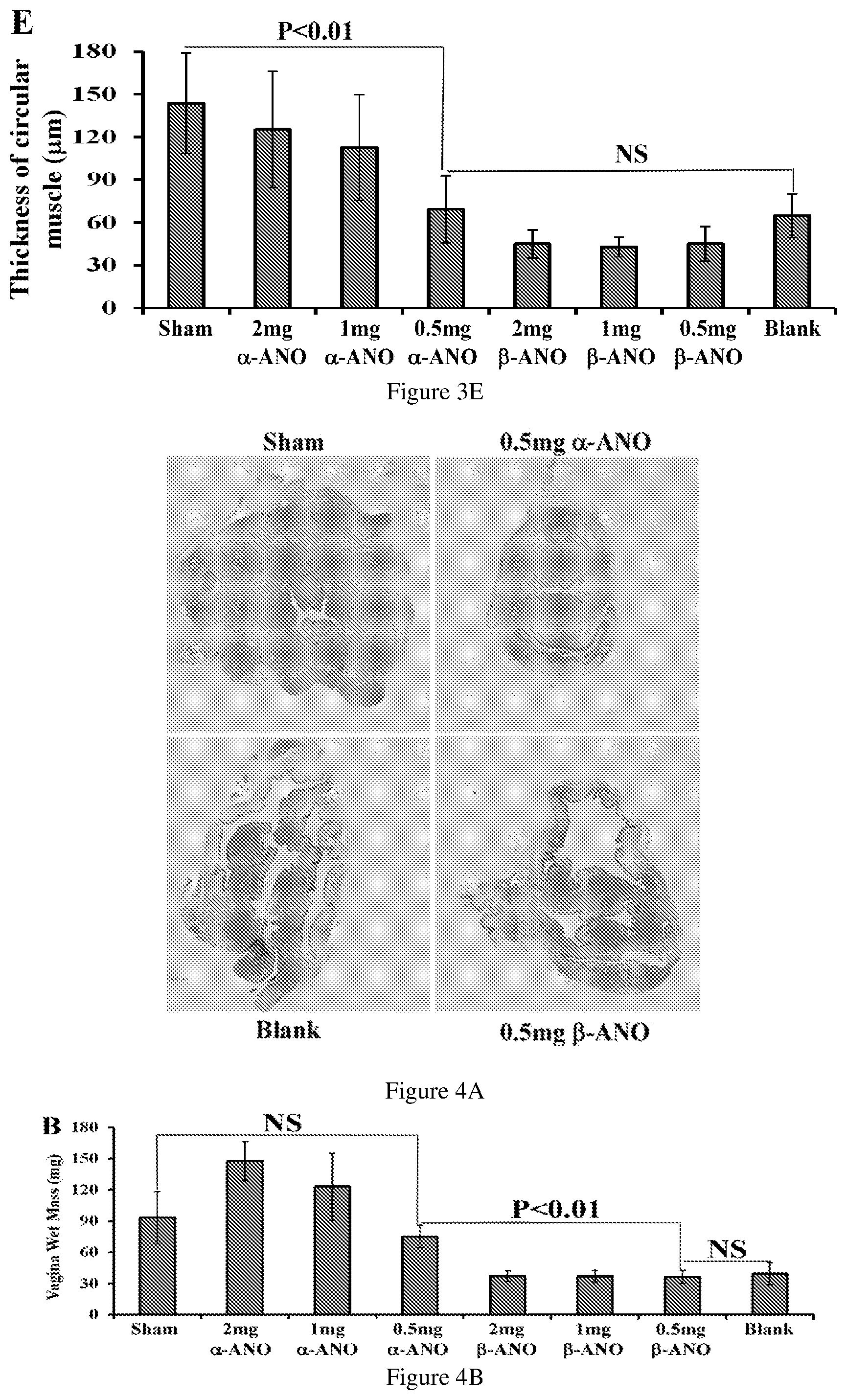 Patent US12403115 Figure 5 – Asymmetric synthesis and uses of compounds in disease treatments