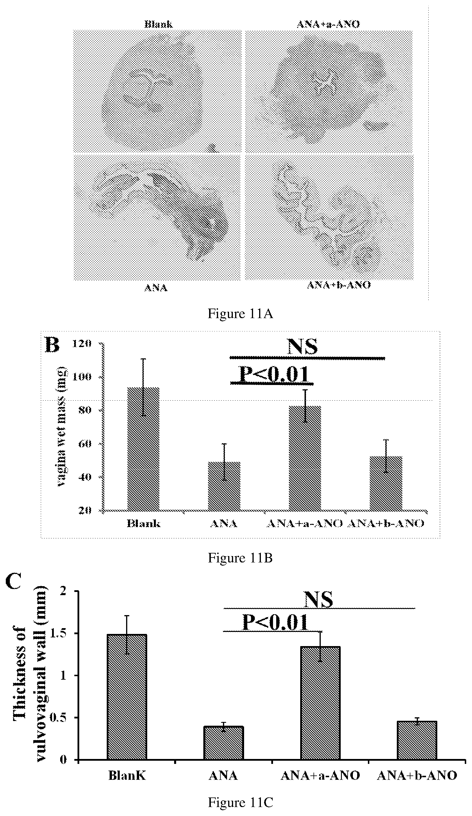 Patent US12403115 Figure 12 – Asymmetric synthesis and uses of compounds in disease treatments