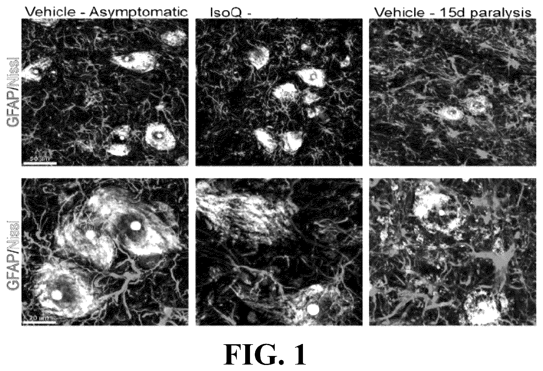 Patent US12403122 Figure 1 – Method for treating amyotrophic lateral sclerosis using quercetin-containing compositions