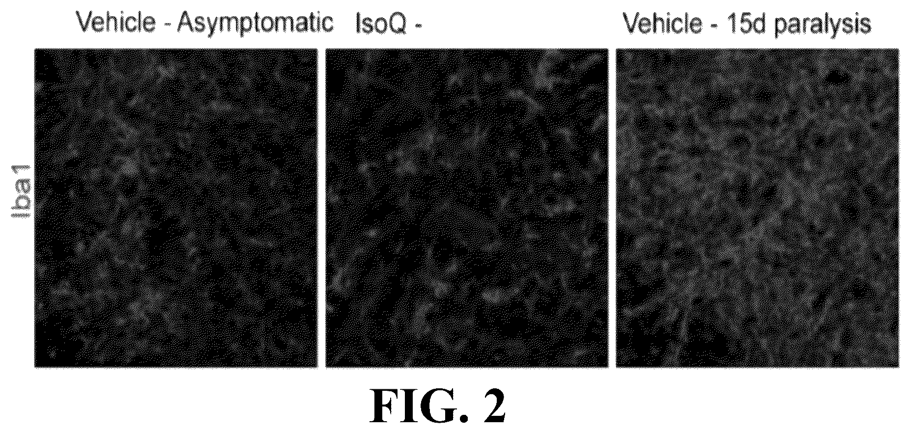 Patent US12403122 Figure 2 – Method for treating amyotrophic lateral sclerosis using quercetin-containing compositions