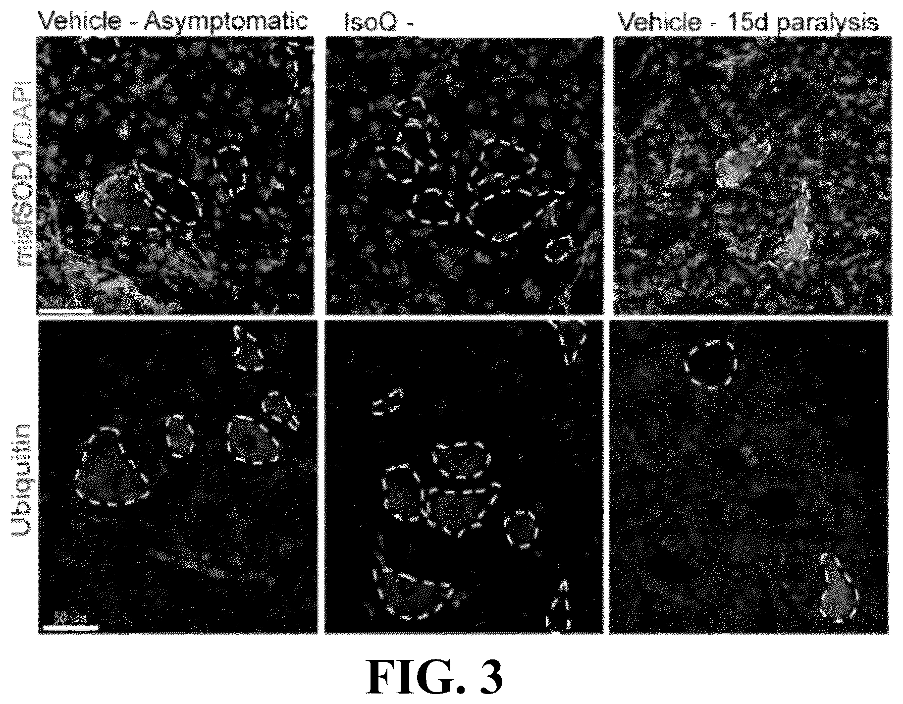 Patent US12403122 Figure 3 – Method for treating amyotrophic lateral sclerosis using quercetin-containing compositions