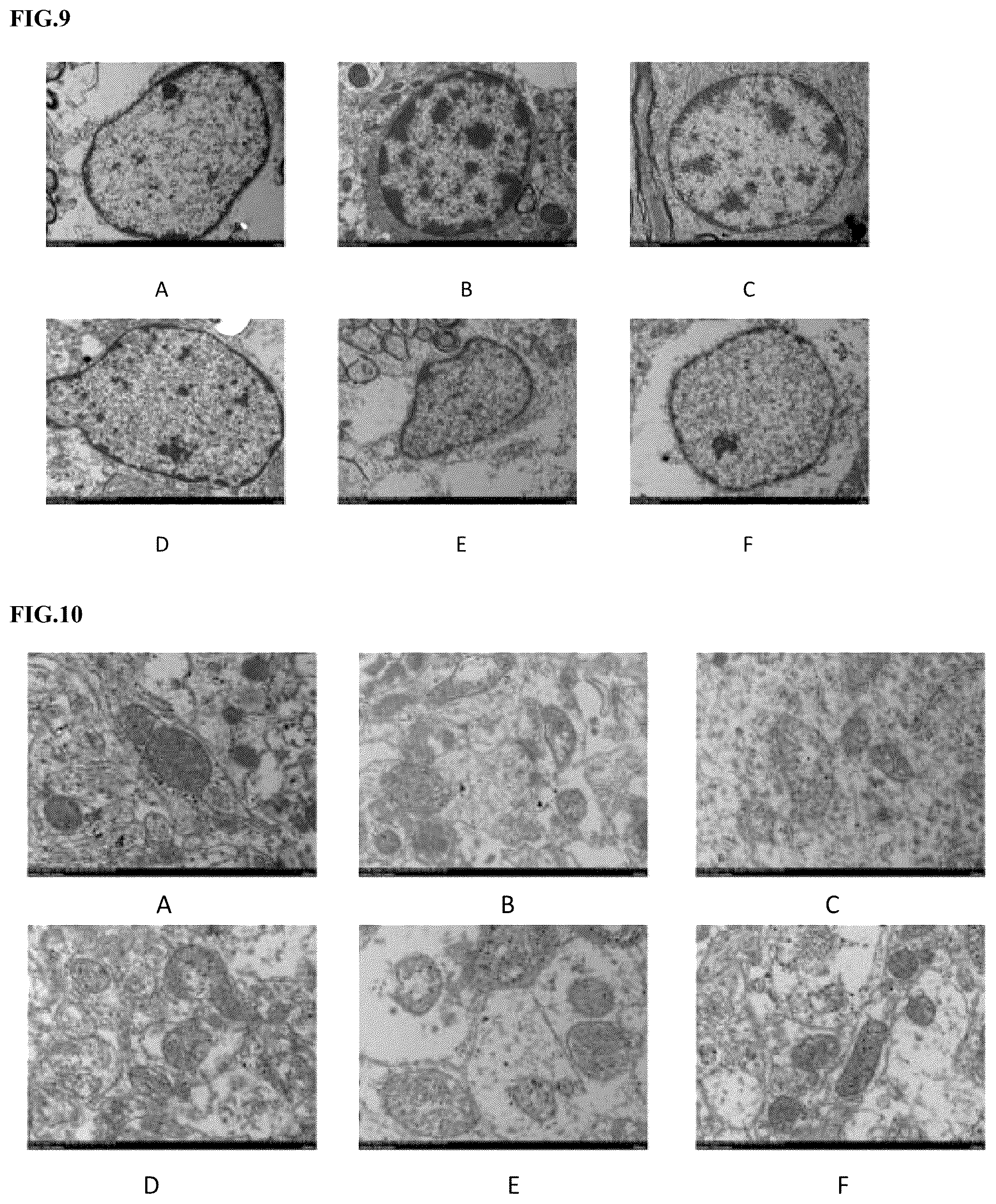 Patent US12403129 Figure 6 – Isotope-enriched 3-amino-1-propanesulfonic acid derivatives for the treatment of cerebrovascular disease