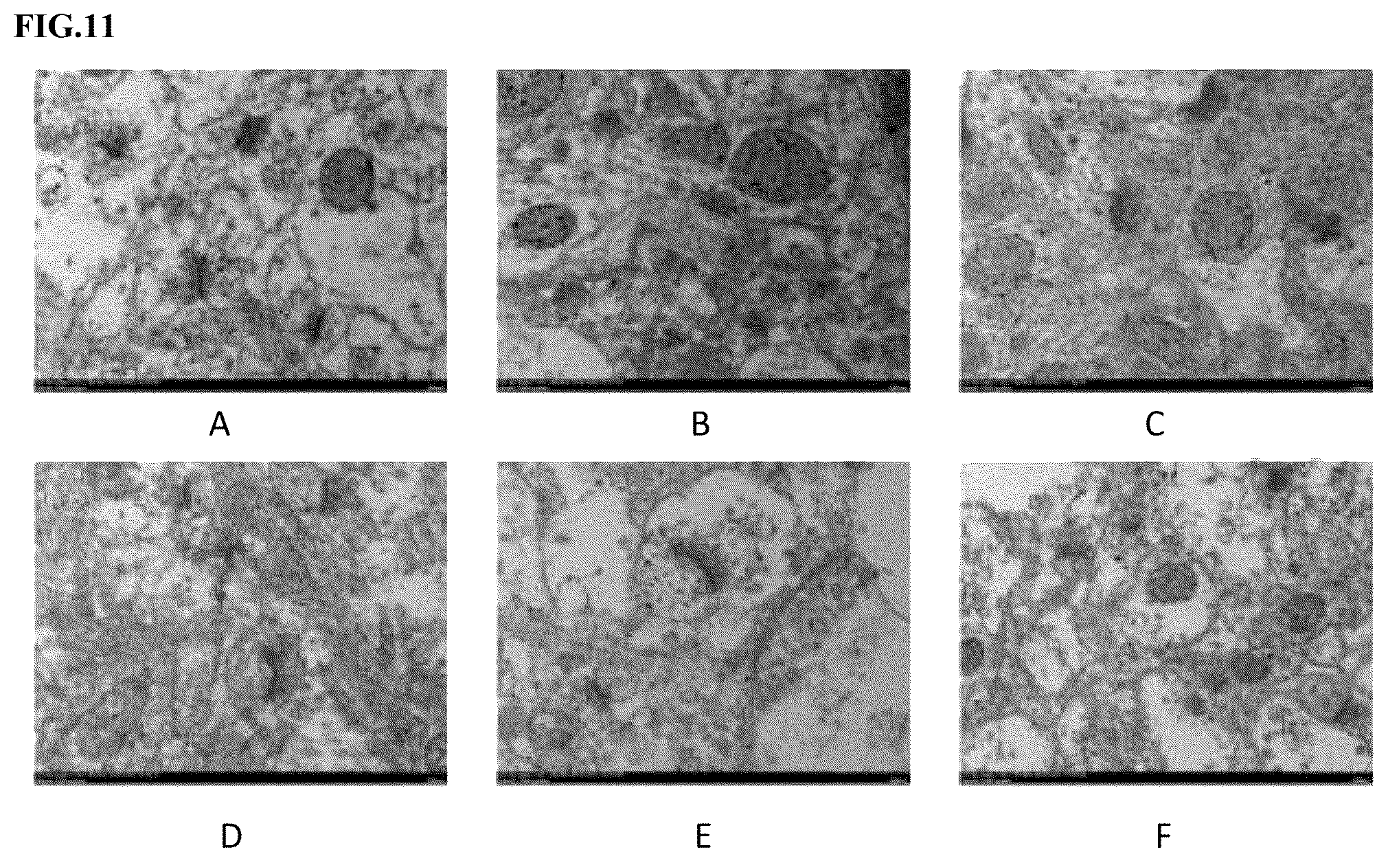 Patent US12403129 Figure 7 – Isotope-enriched 3-amino-1-propanesulfonic acid derivatives for the treatment of cerebrovascular disease