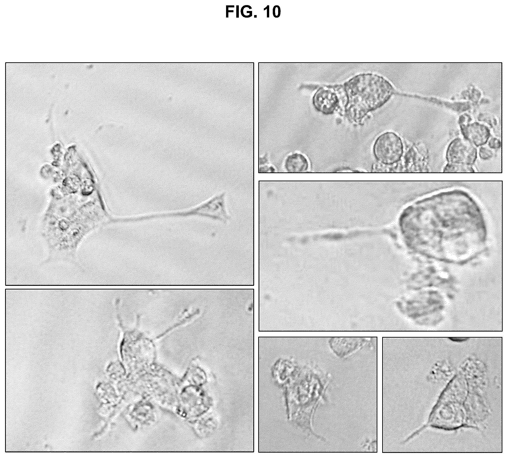 Patent US12403150 Figure 10 – Tryptamine compositions for enhancing neurite outgrowth
