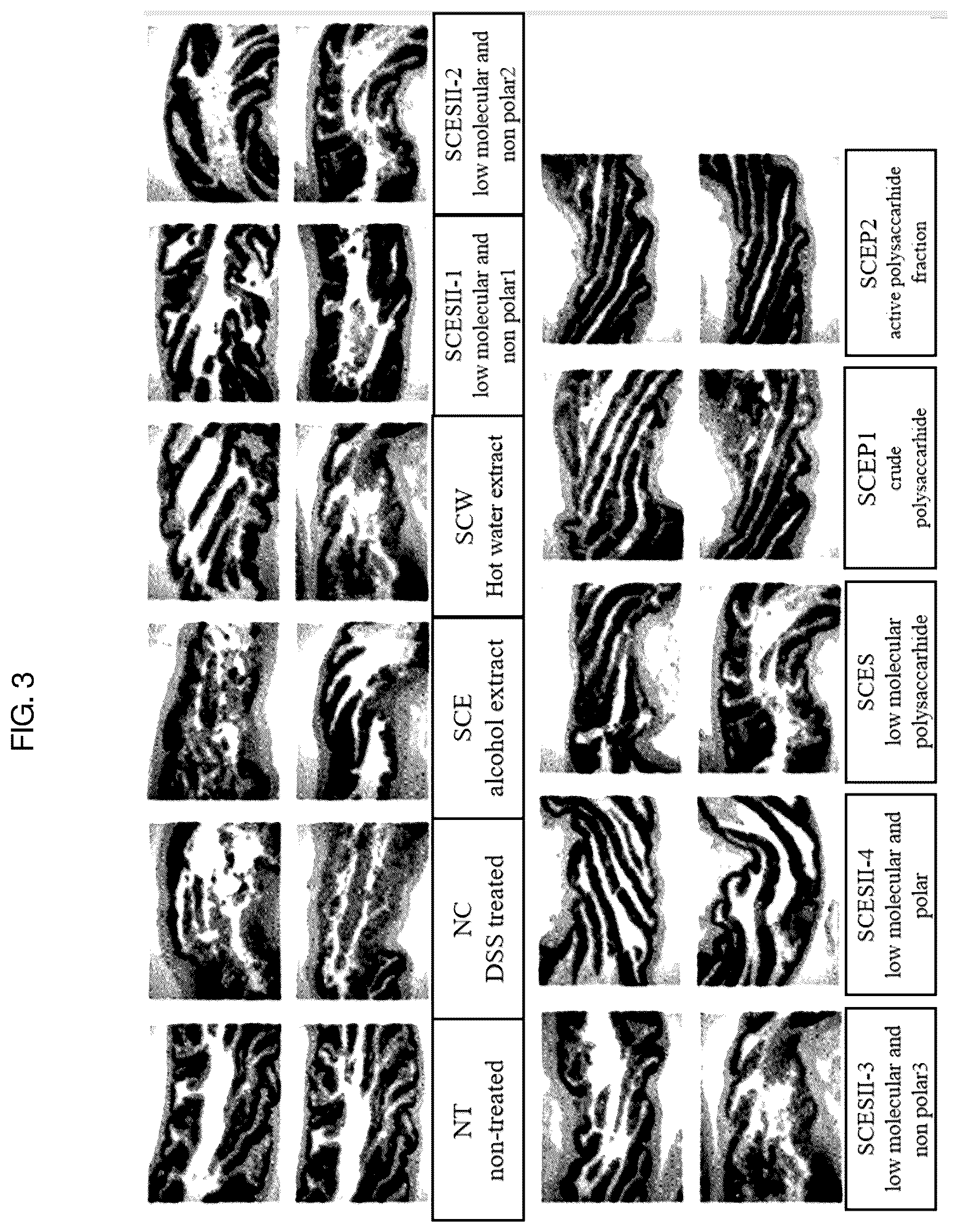 Patent US12403170 Figure 4 – Pharmaceutical composition containing Saururus chinensis fraction, and preparation method thereof