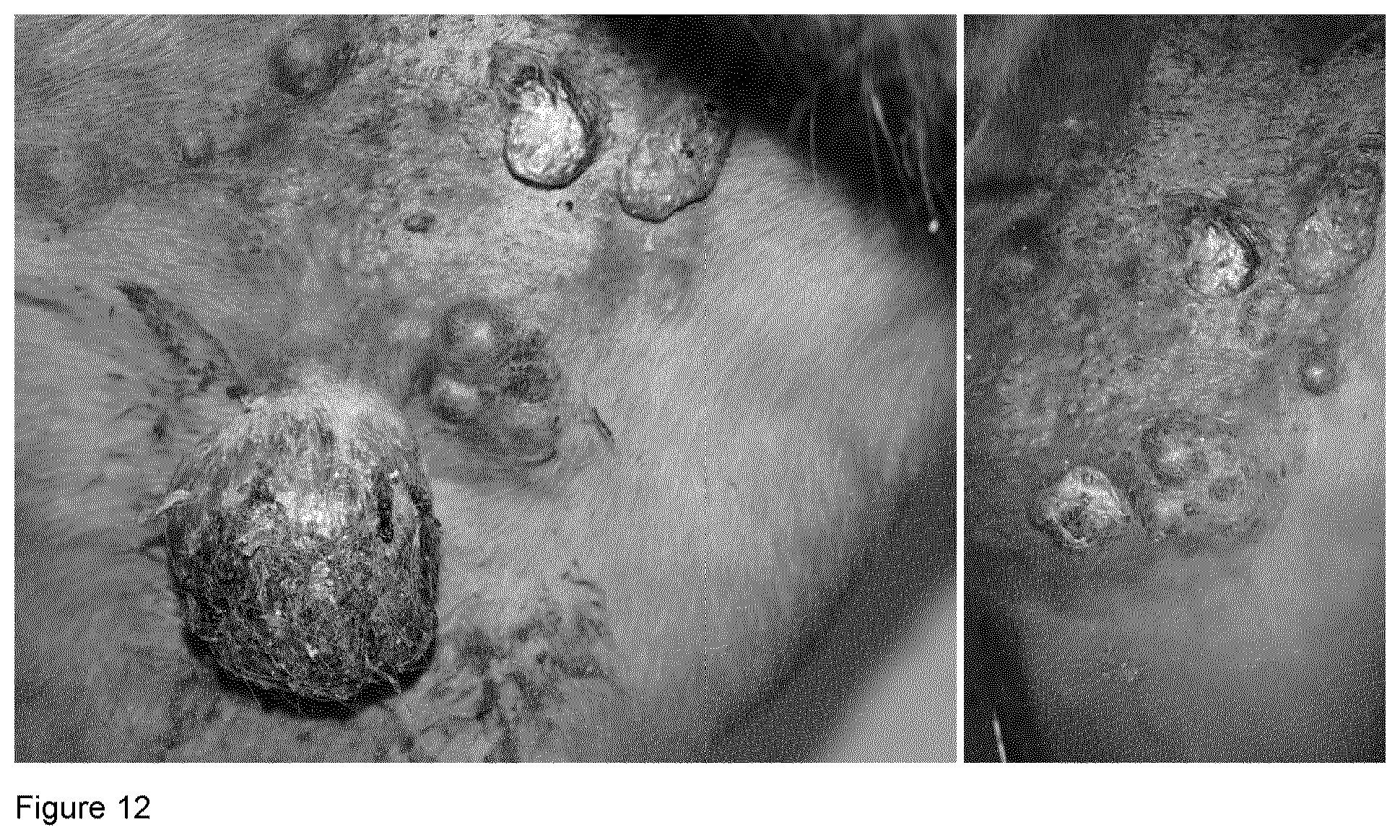 Patent US12403187 Figure 11 – Bacterial vaccine