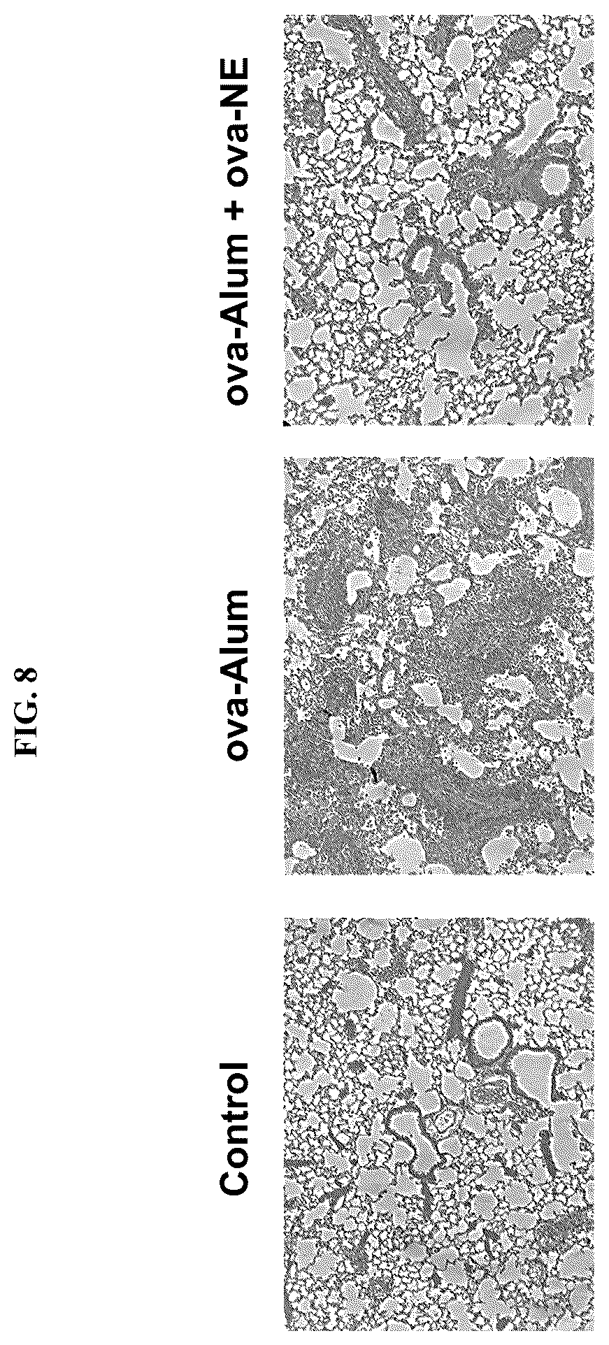 Patent US12403192 Figure 8 – Nanoemulsion compositions for preventing, suppressing or eliminating allergic and inflammatory disease