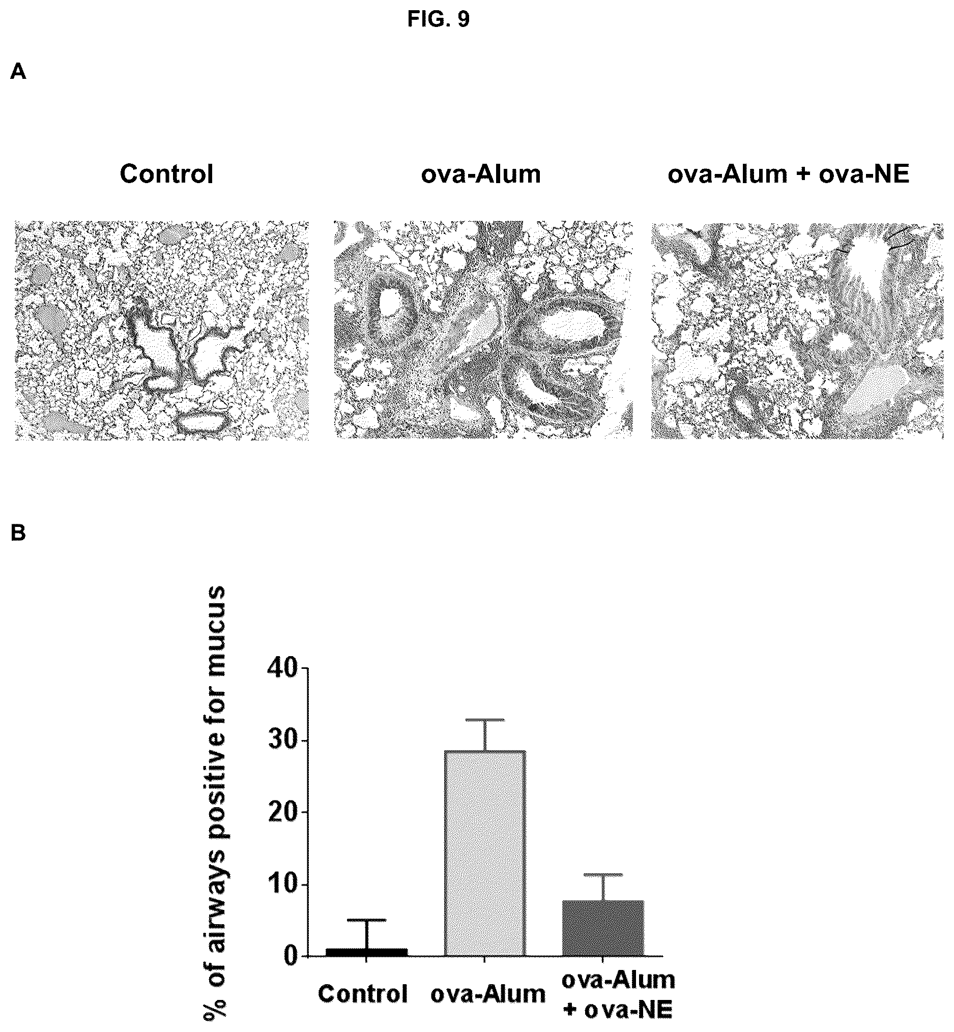 Patent US12403192 Figure 9 – Nanoemulsion compositions for preventing, suppressing or eliminating allergic and inflammatory disease