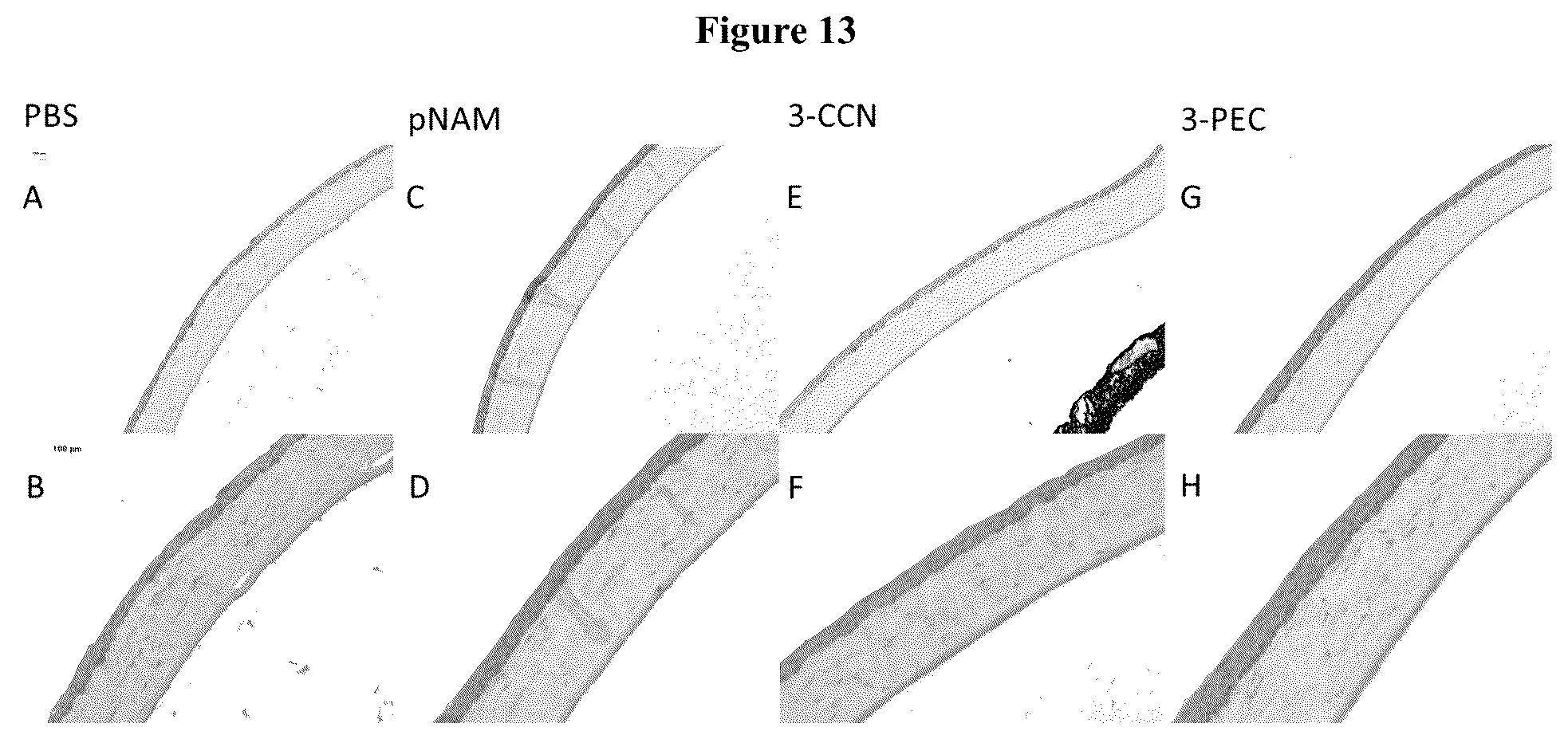 Patent US12403197 Figure 13 – Polymer system for ophthalmic drug delivery