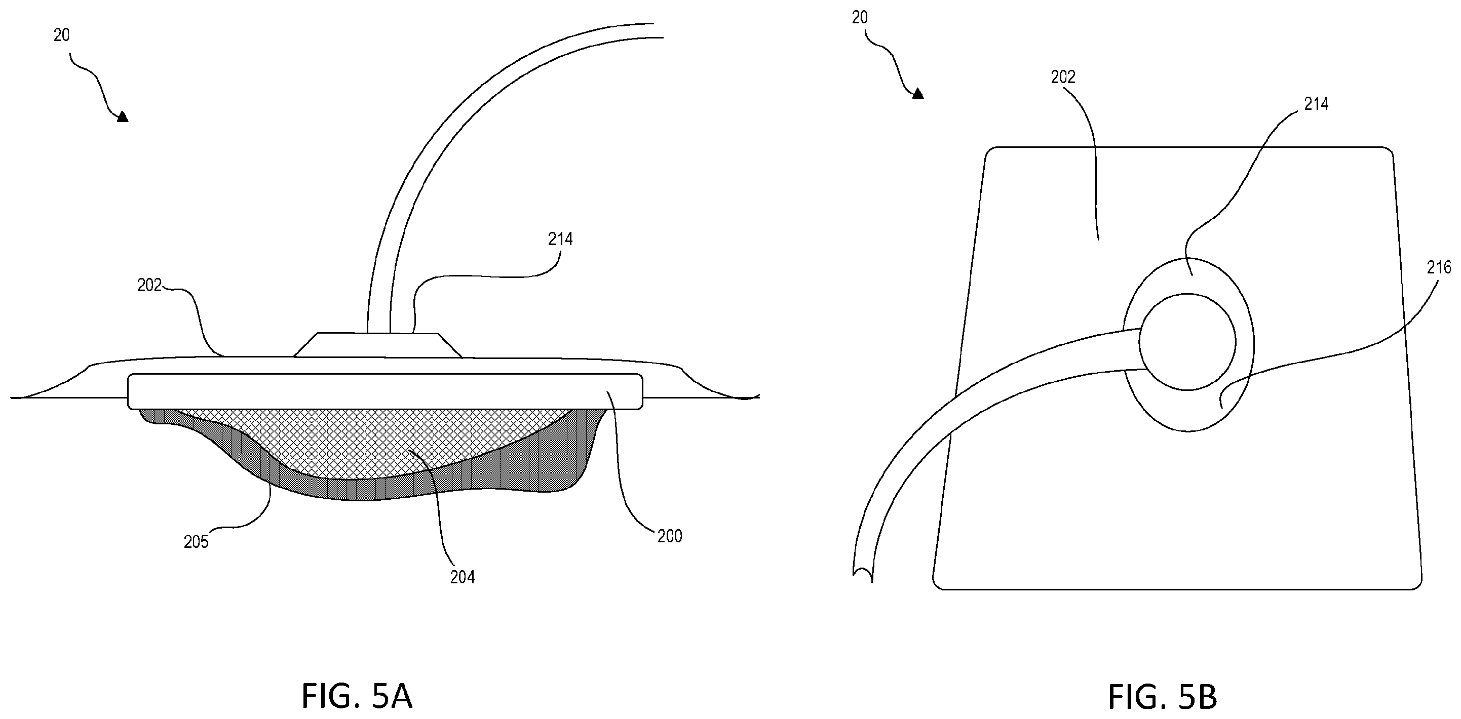 Patent US12403213 Figure 5 – Wound dressing with selective and dynamic transparency