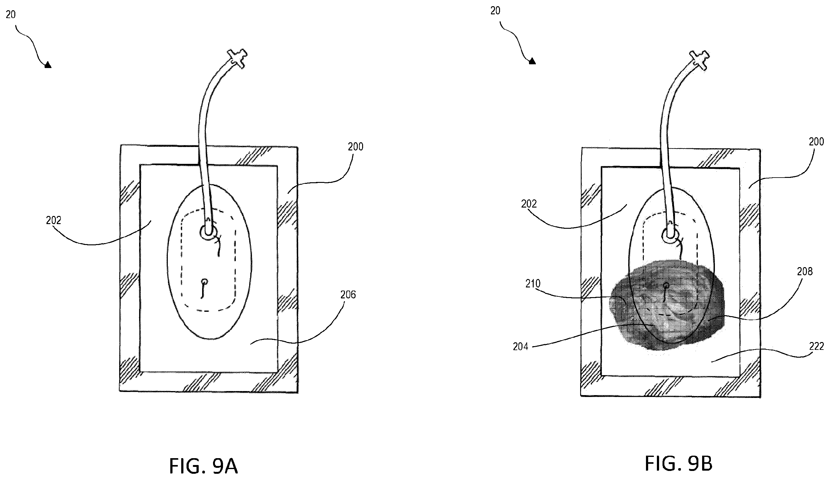 Patent US12403213 Figure 9 – Wound dressing with selective and dynamic transparency