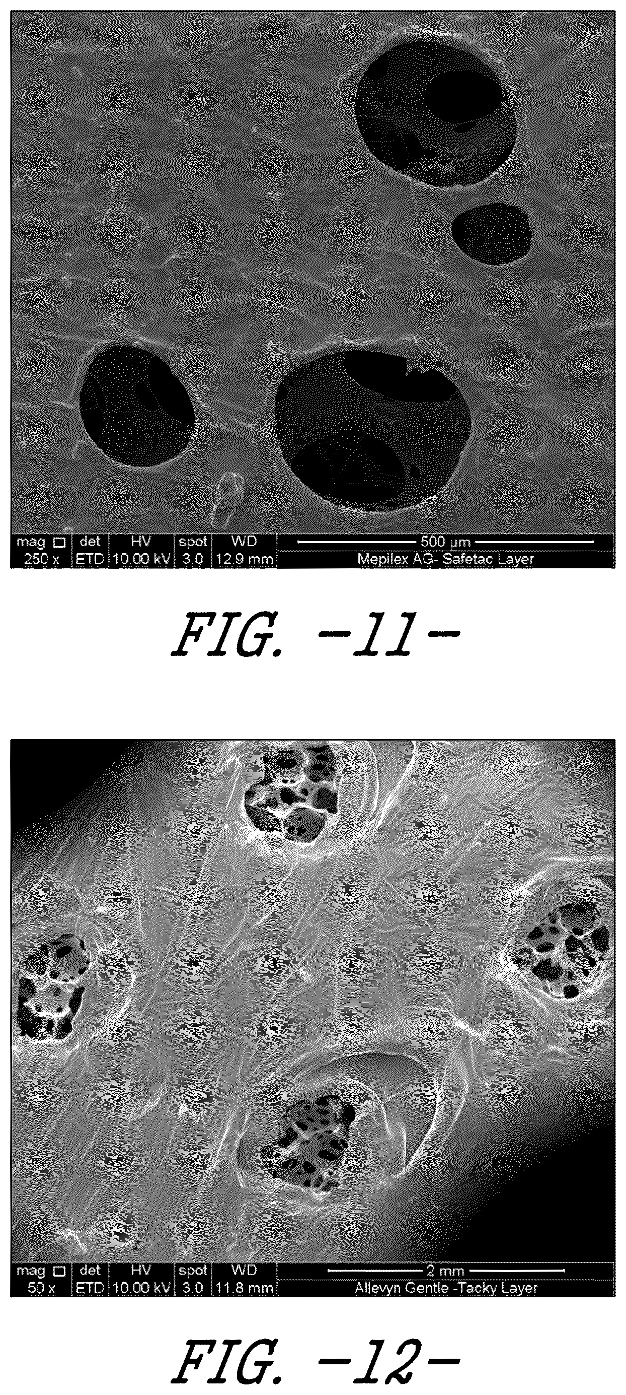 Patent US12403214 Figure 10 – Wound care device having fluid transfer and adhesive properties