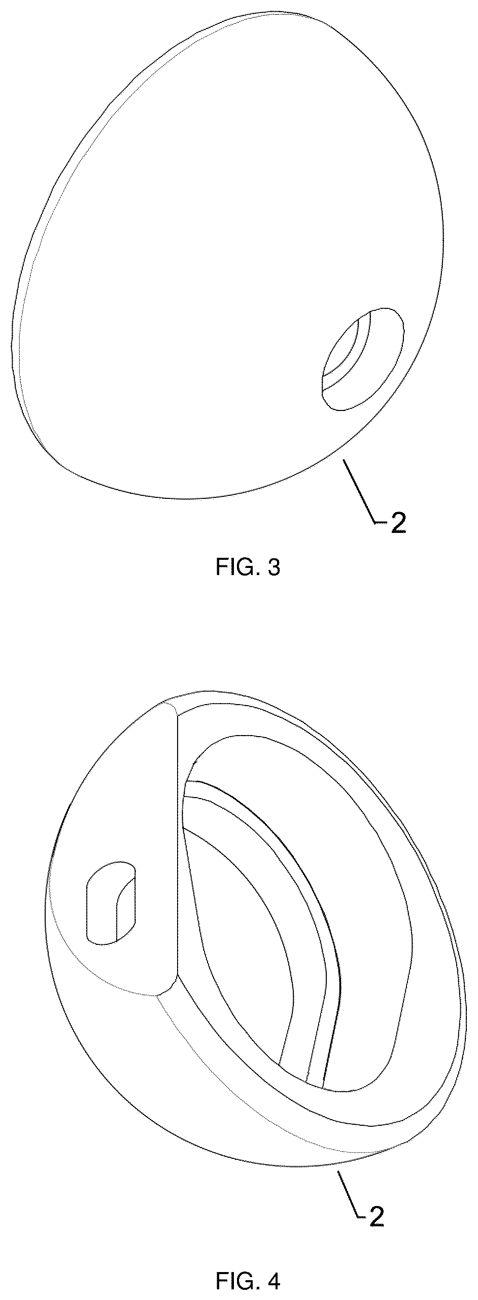 Patent US12403215 Figure 2 – Oxide layer-containing zirconium-niobium alloy shoulder joint prosthesis system and preparation method