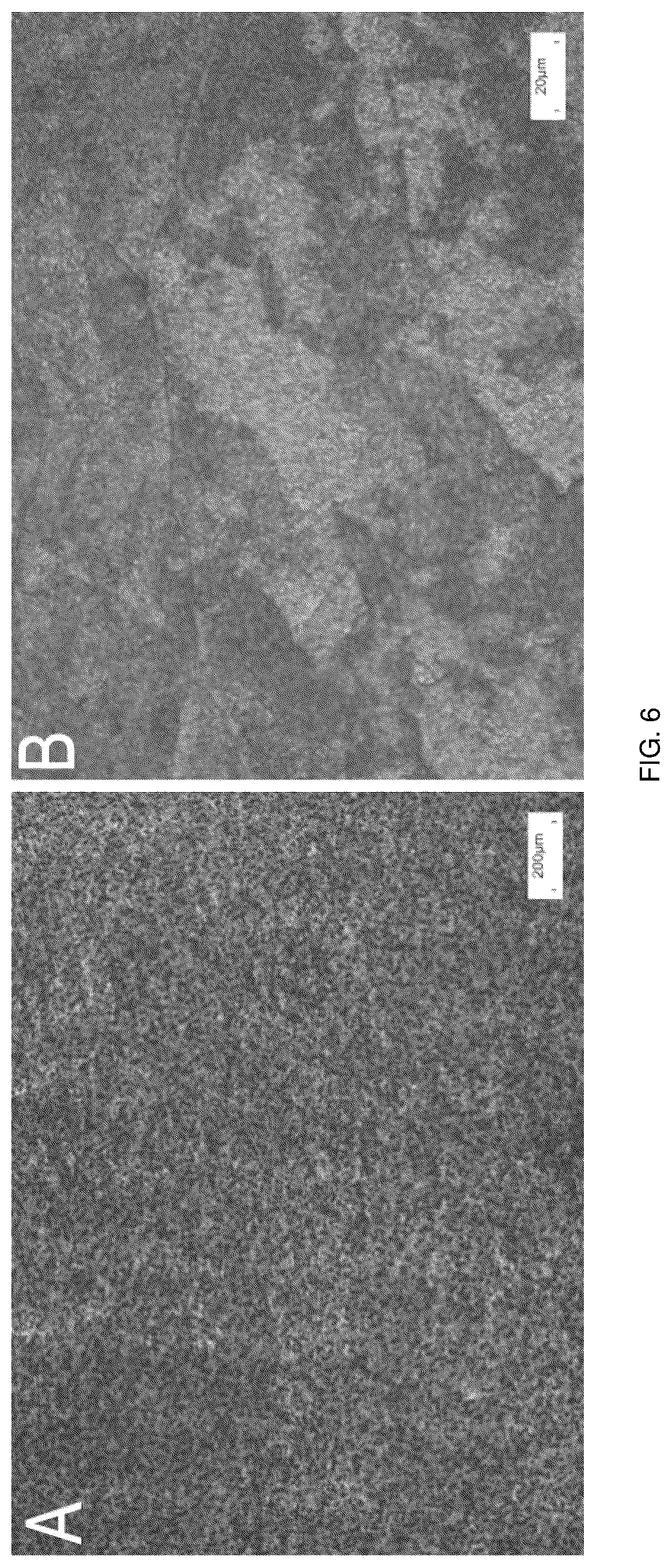 Patent US12403215 Figure 4 – Oxide layer-containing zirconium-niobium alloy shoulder joint prosthesis system and preparation method
