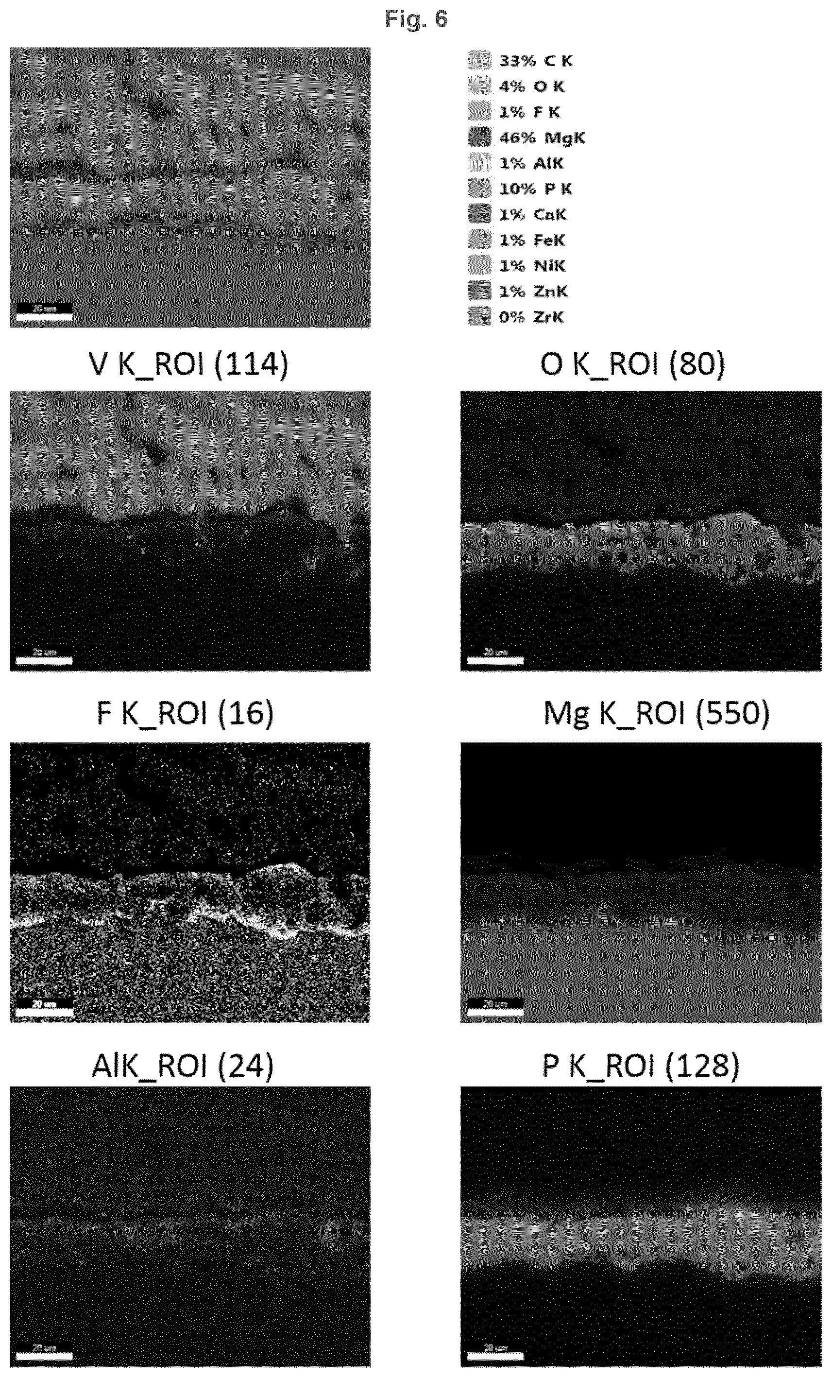 Patent US12403217 Figure 6 – Biodegradeable implant comprising coated metal alloy product