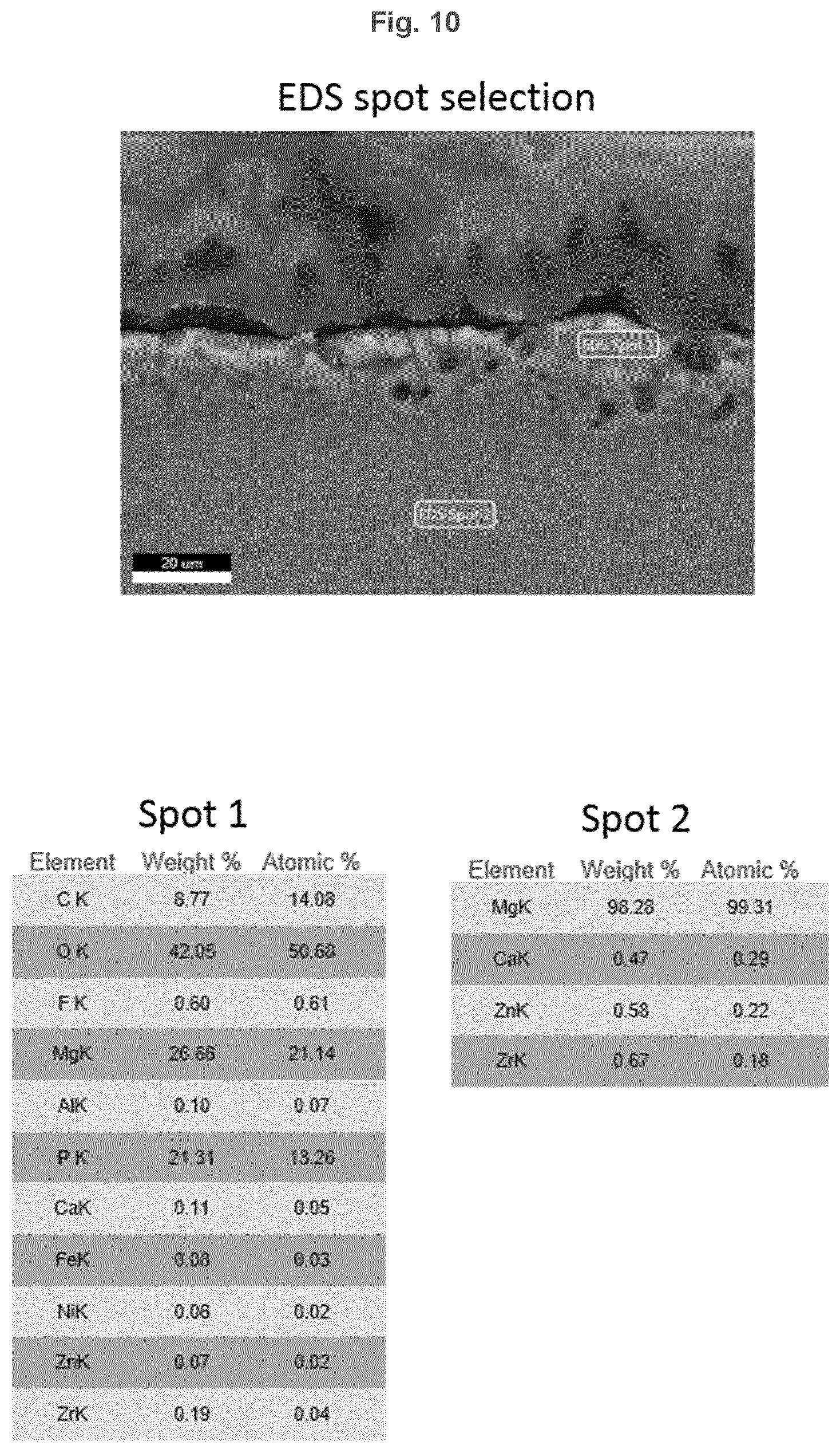 Patent US12403217 Figure 10 – Biodegradeable implant comprising coated metal alloy product