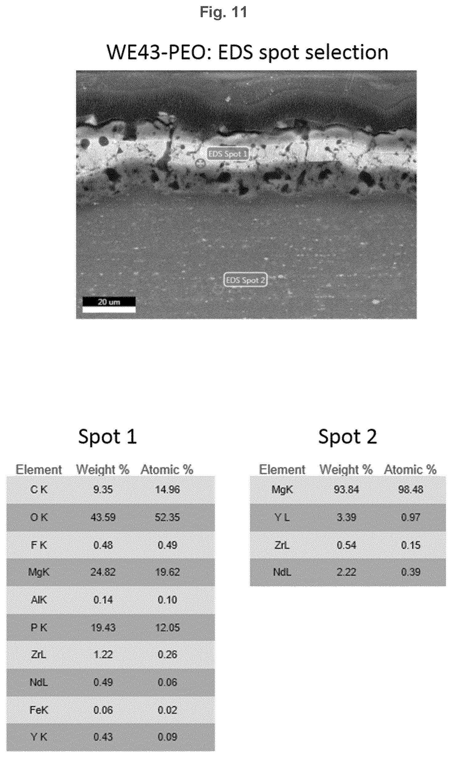 Patent US12403217 Figure 11 – Biodegradeable implant comprising coated metal alloy product