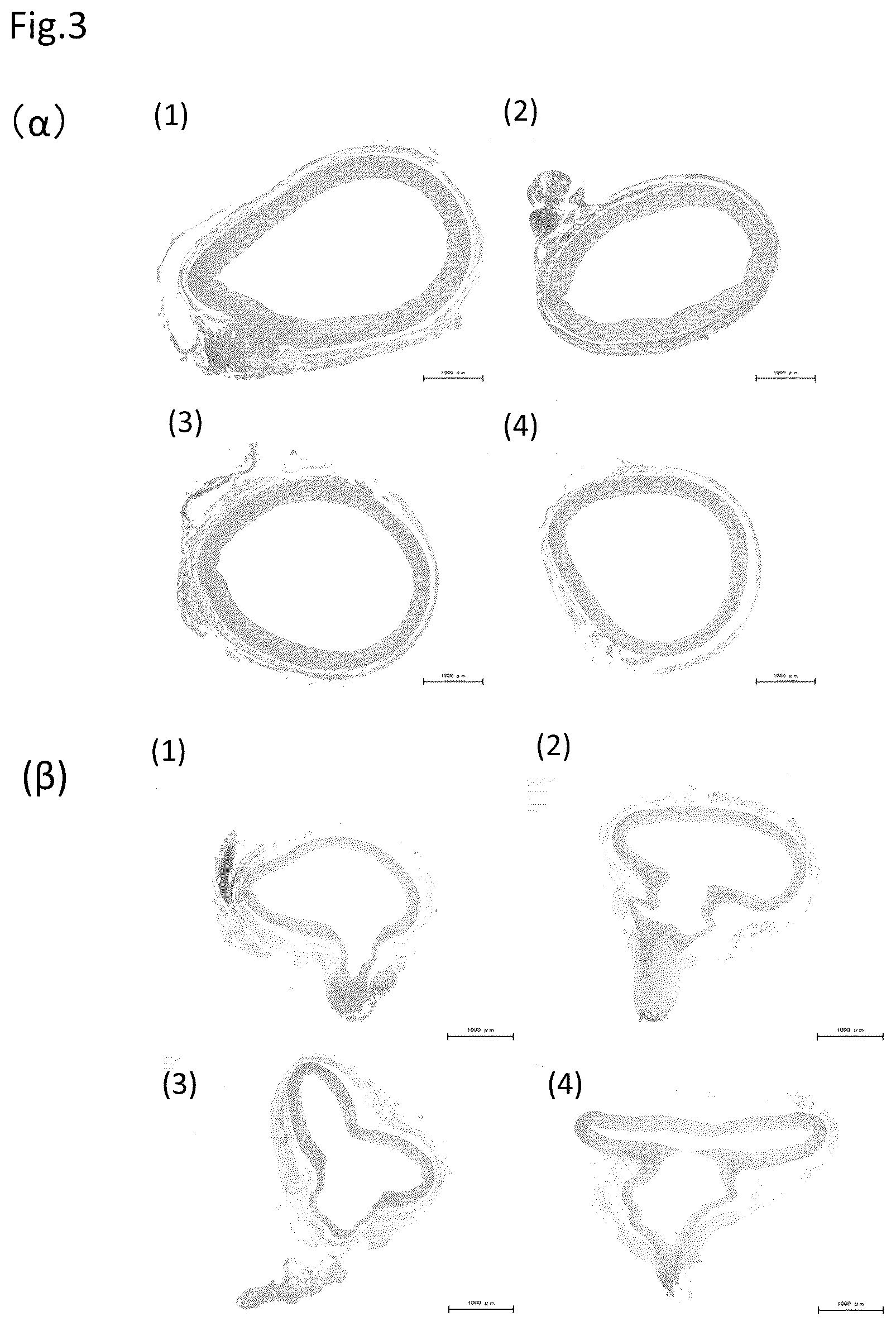 Patent US12403219 Figure 2 – Method for producing decellularized material for transplantation and graft composition consisting of biocompatible material including said material