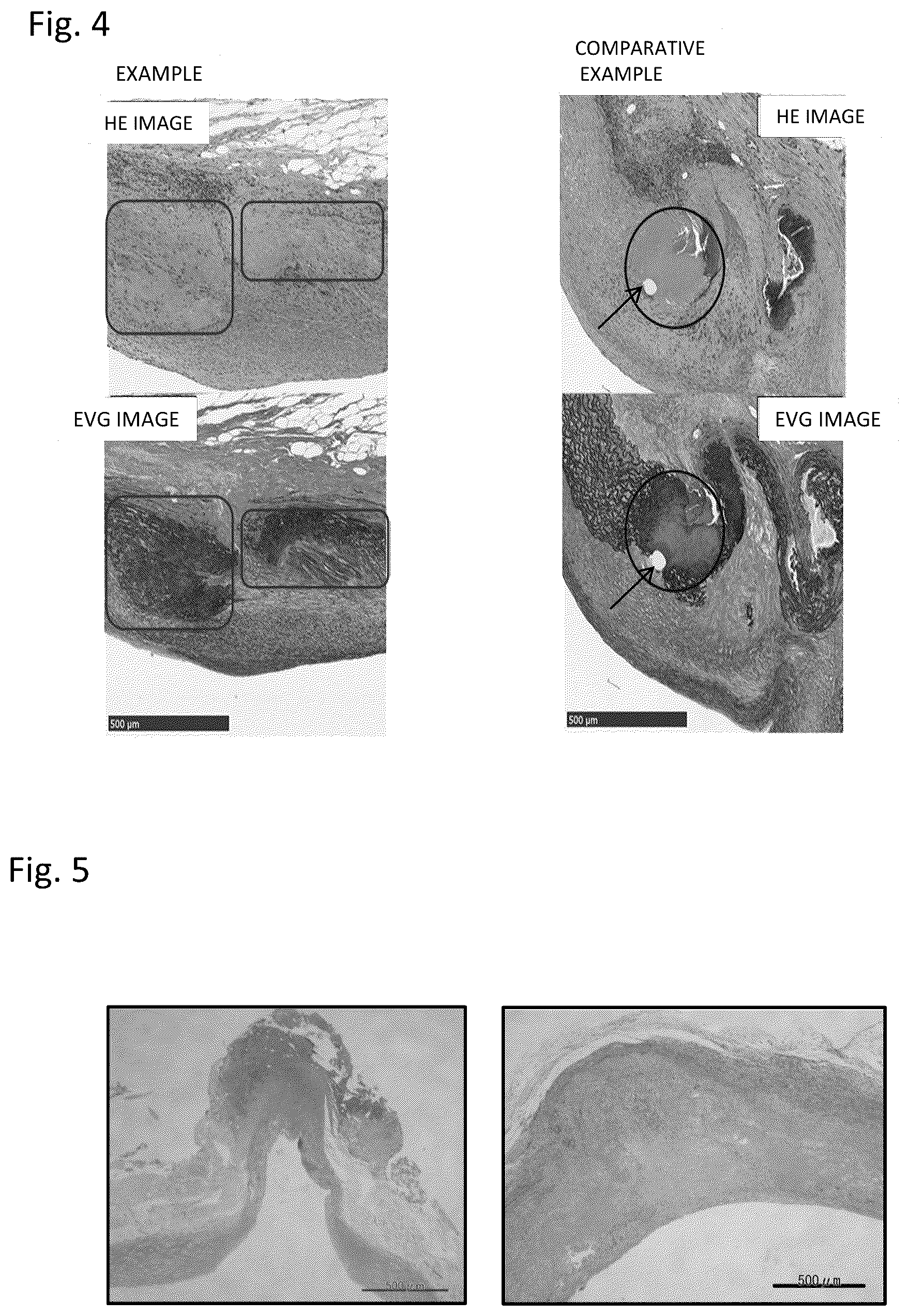 Patent US12403219 Figure 3 – Method for producing decellularized material for transplantation and graft composition consisting of biocompatible material including said material
