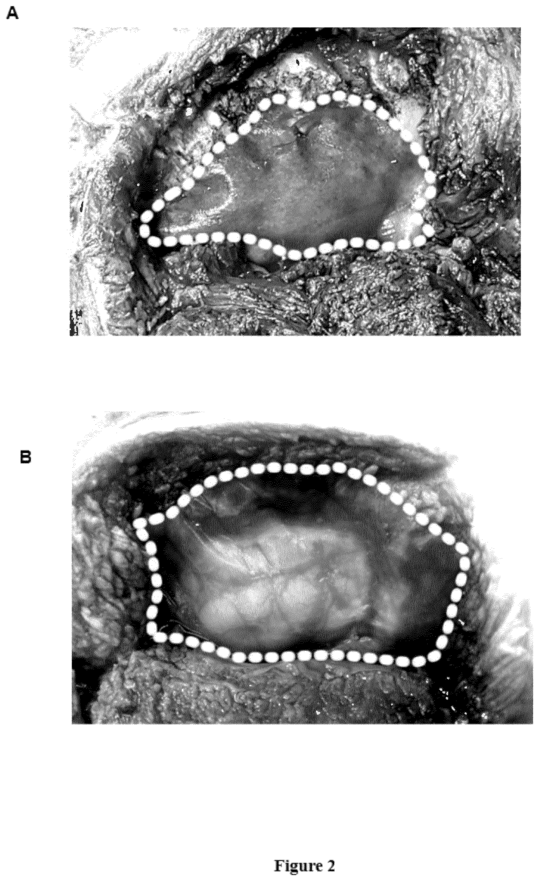 Patent US12403221 Figure 2 – Preparation of composite gels, polymer scaffolds, aggregates and films comprising soluble cross-linked chitosan and uses thereof