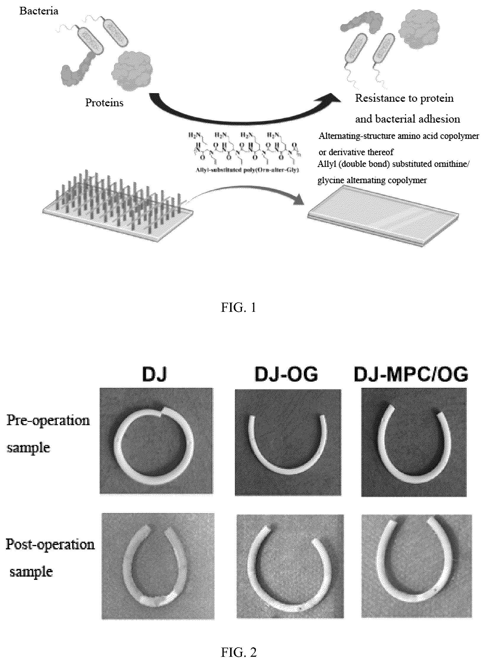 Patent US12403223 Figure 1 – Method for constructing hydrophilic antifouling coating on surface of medical implantable material