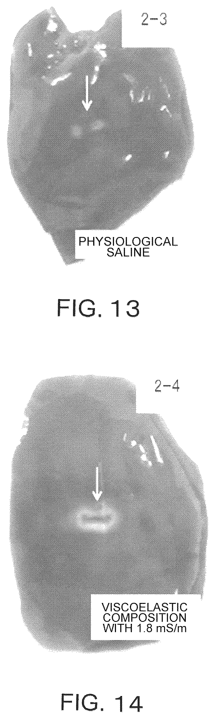 Patent US12403224 Figure 11 – Viscoelastic composition