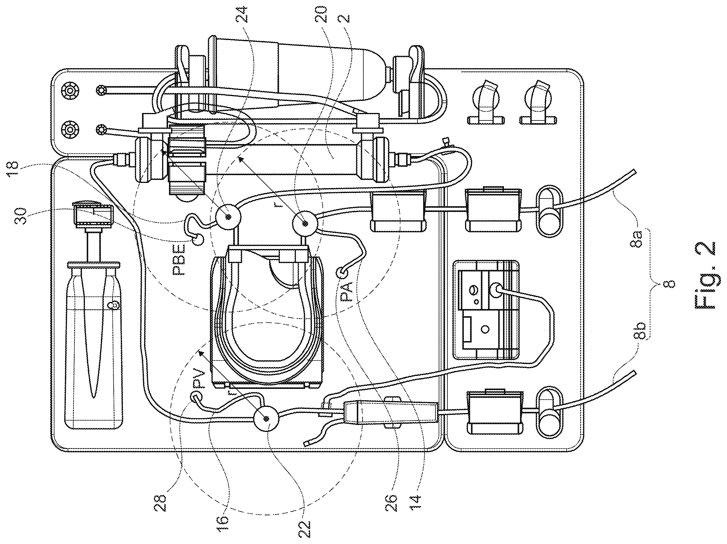 Patent US12403232 Figure 2 – Extracorporeal blood treatment machine comprising a poka-yoke for a pressure sensor