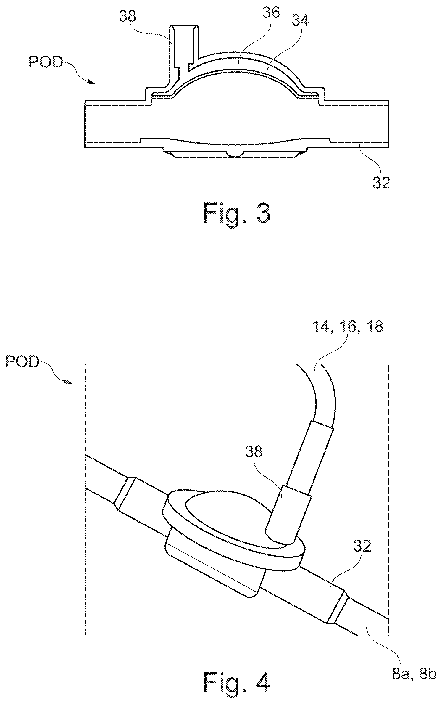 Patent US12403232 Figure 3 – Extracorporeal blood treatment machine comprising a poka-yoke for a pressure sensor