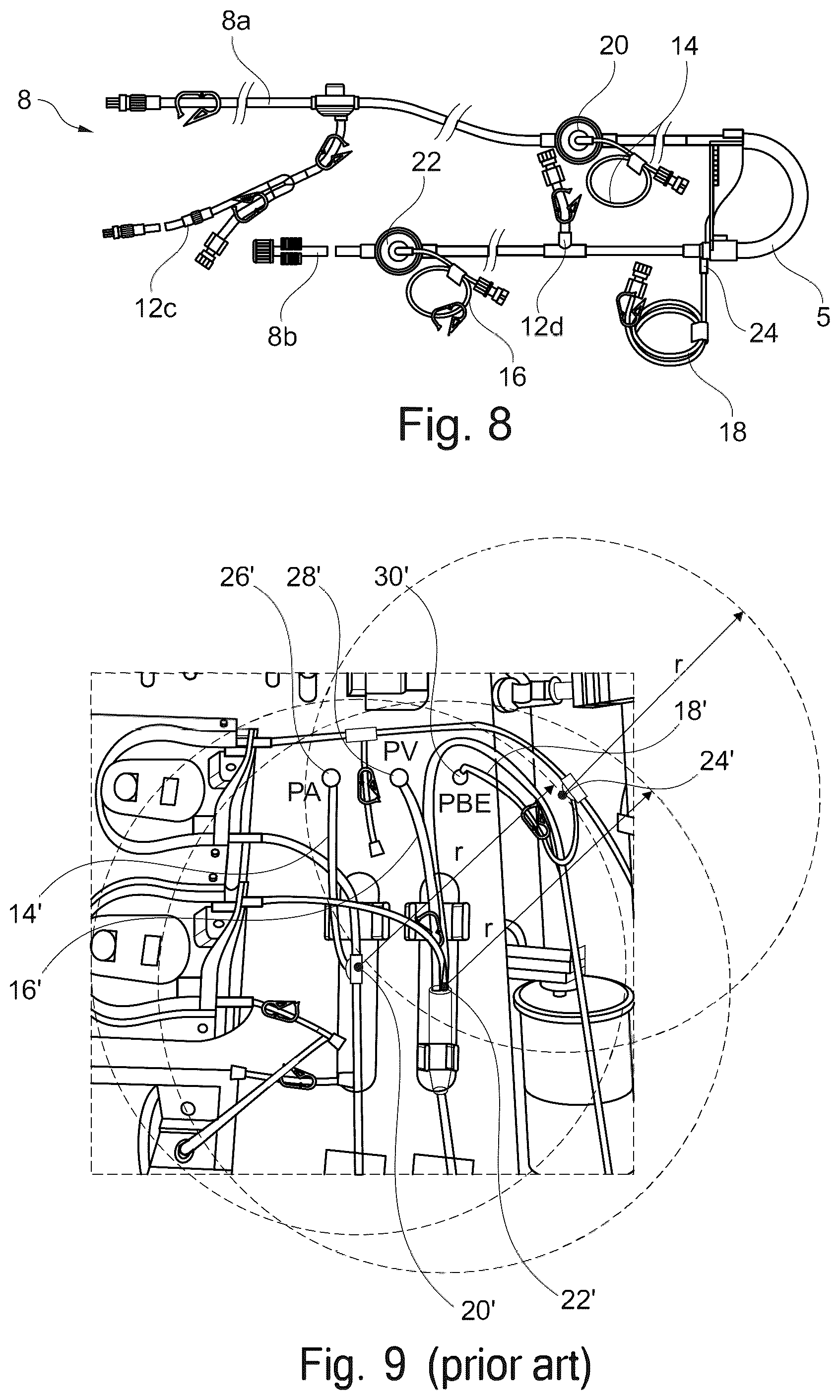 Patent US12403232 Figure 5 – Extracorporeal blood treatment machine comprising a poka-yoke for a pressure sensor