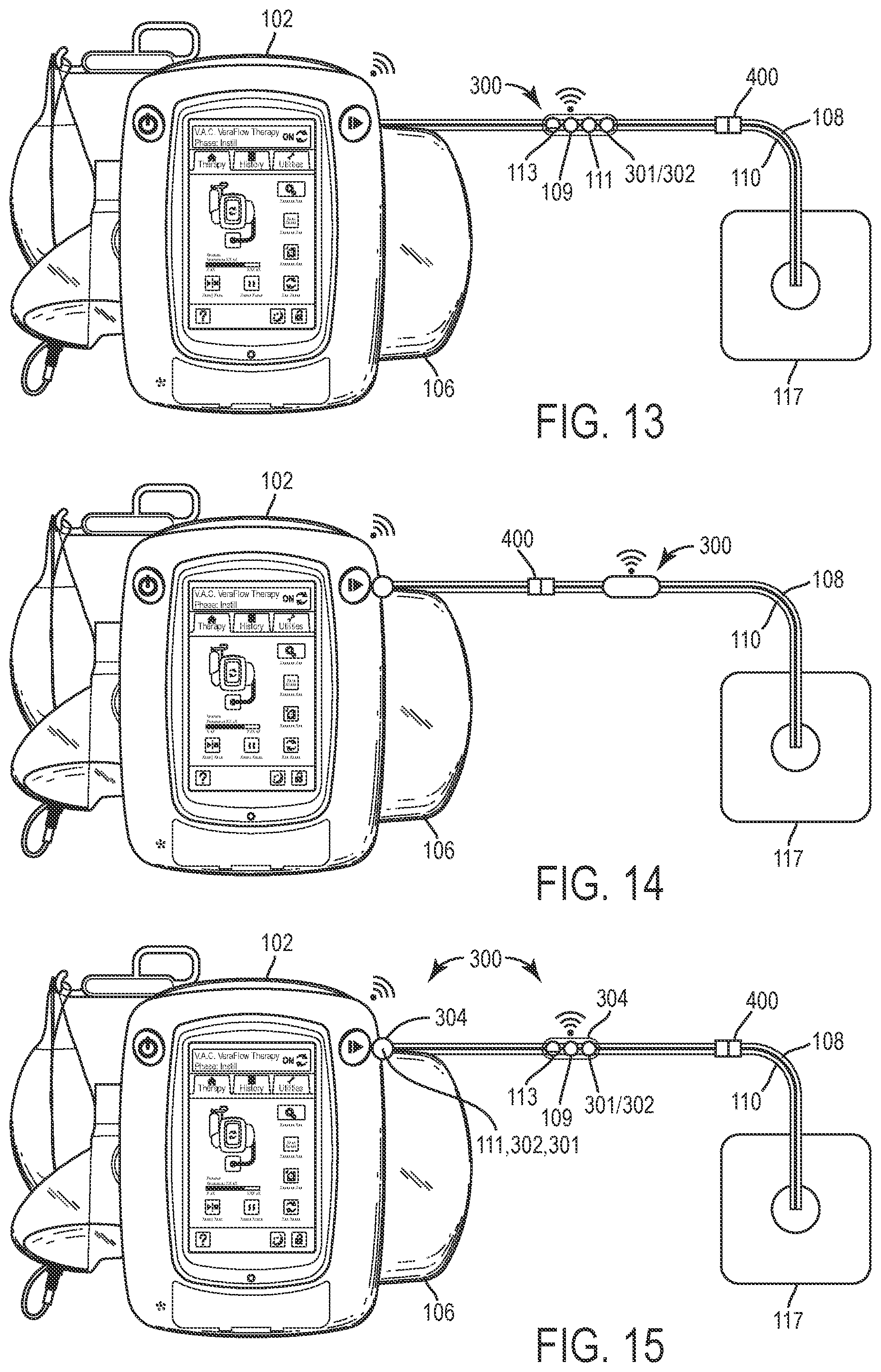 Patent US12403235 Figure 17 – Wound therapy system with internal alternating orifice