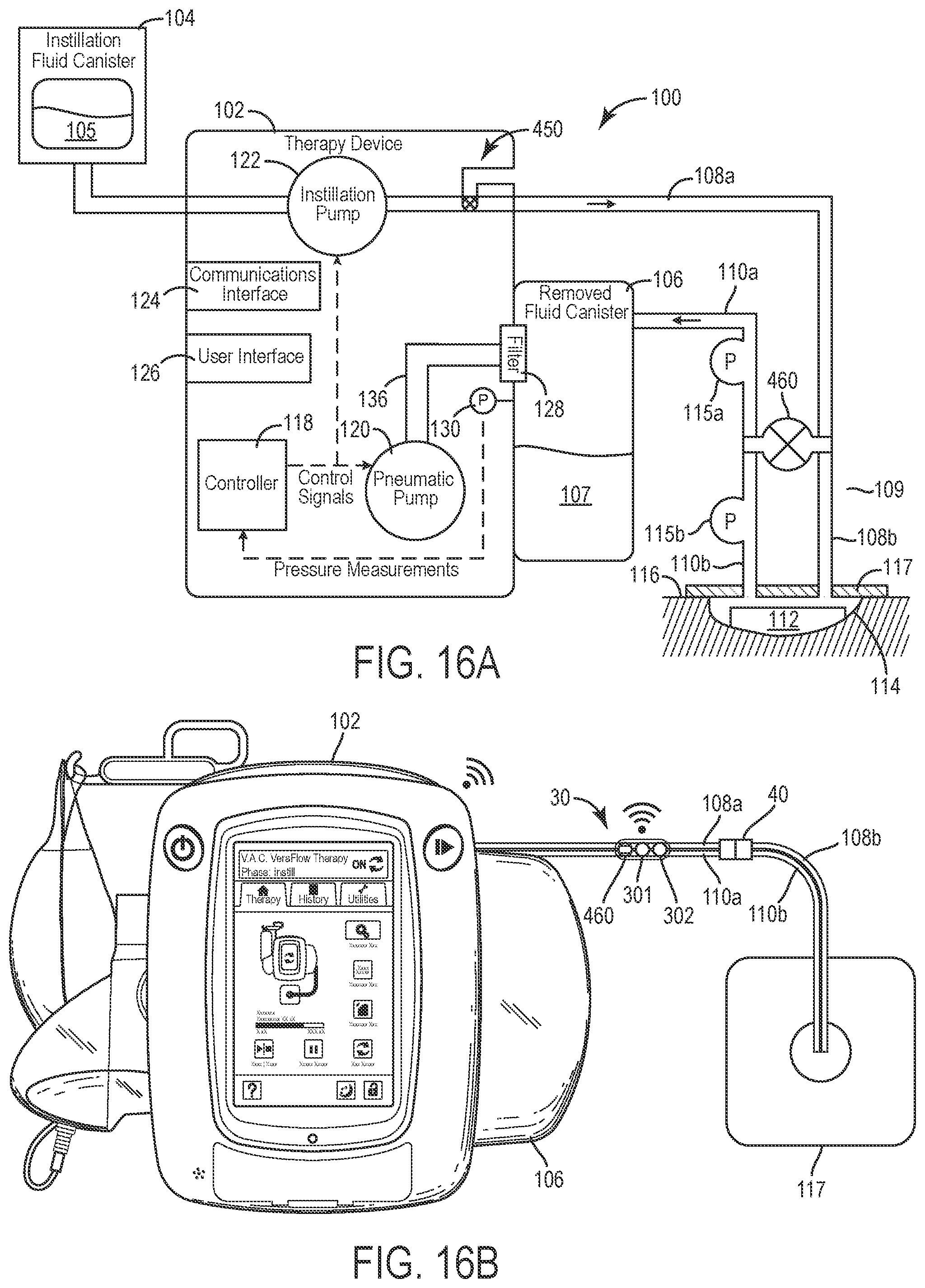 Patent US12403235 Figure 18 – Wound therapy system with internal alternating orifice