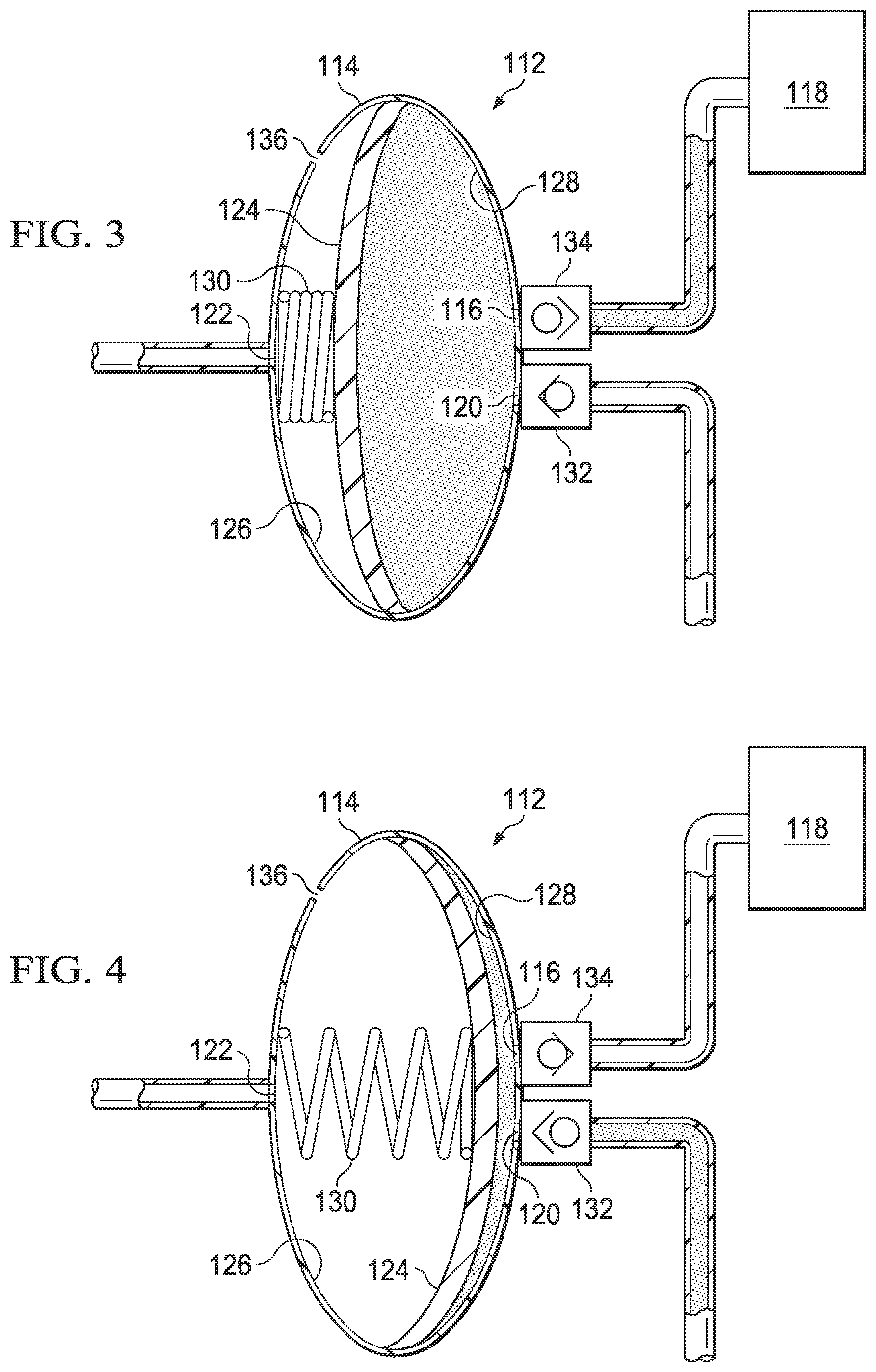 Patent US12403239 Figure 2 – Disposable cartridge for vacuum actuated fluid delivery