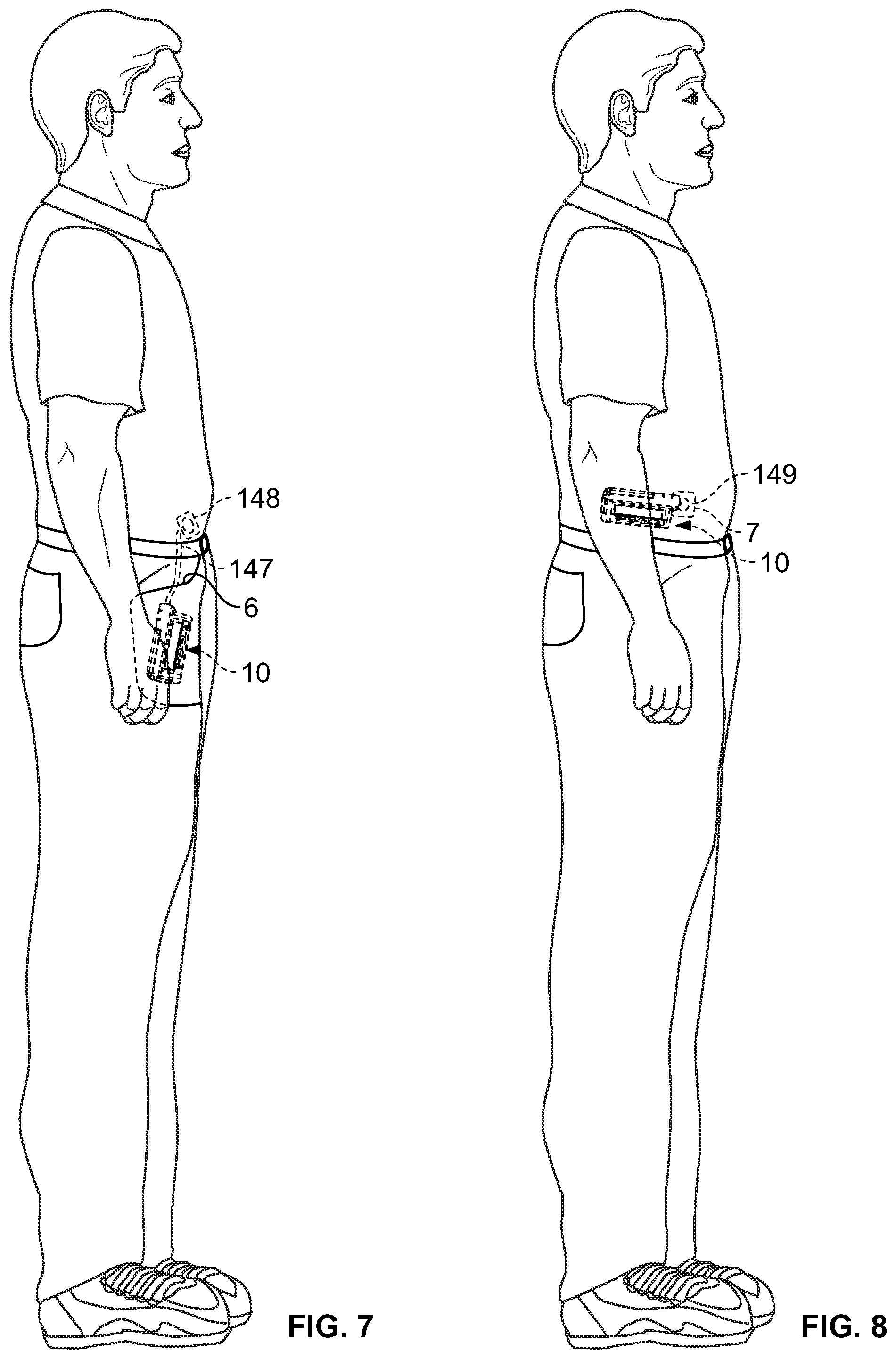 Patent US12403245 Figure 6 – Operating a portable medical device