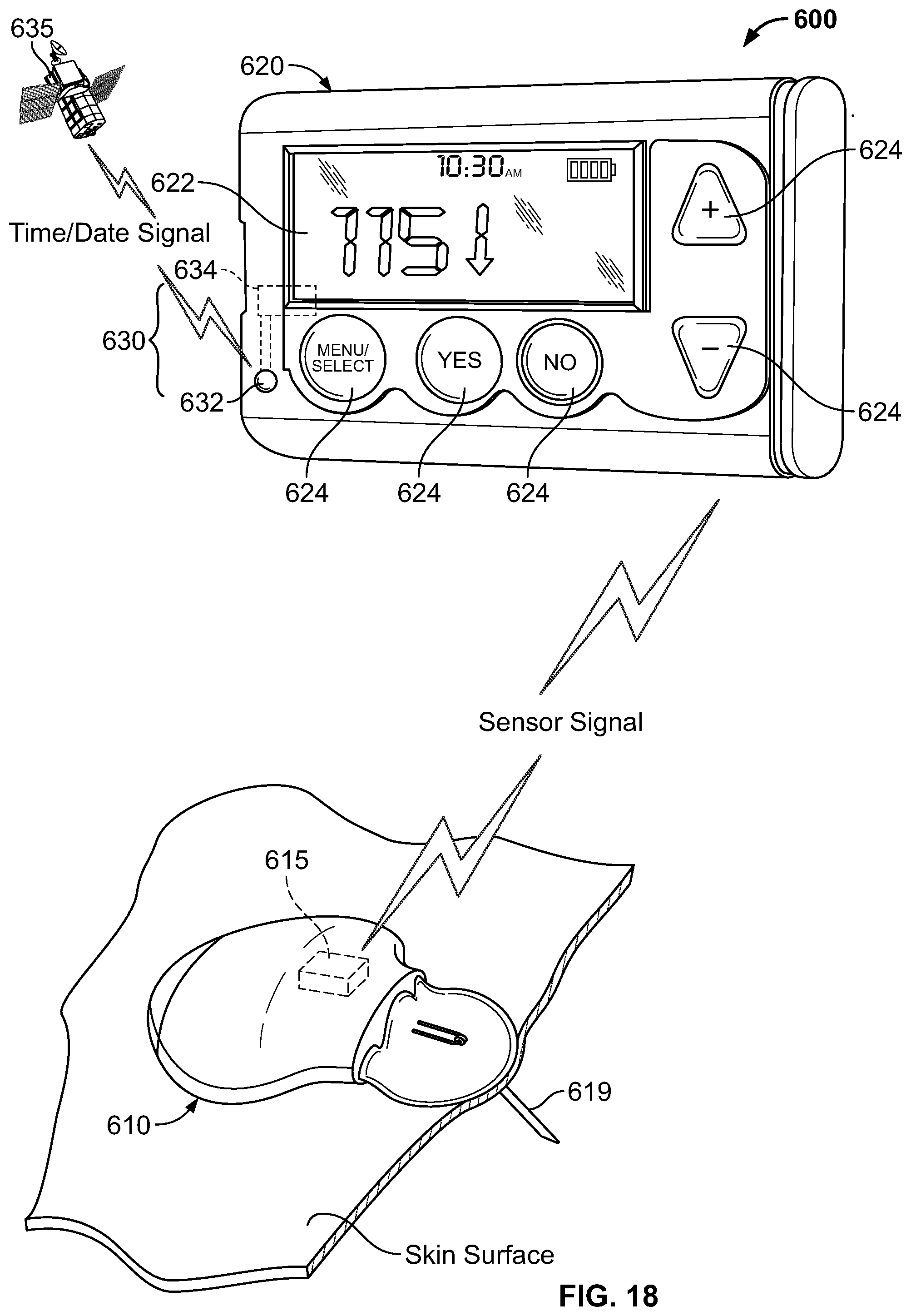 Patent US12403245 Figure 13 – Operating a portable medical device