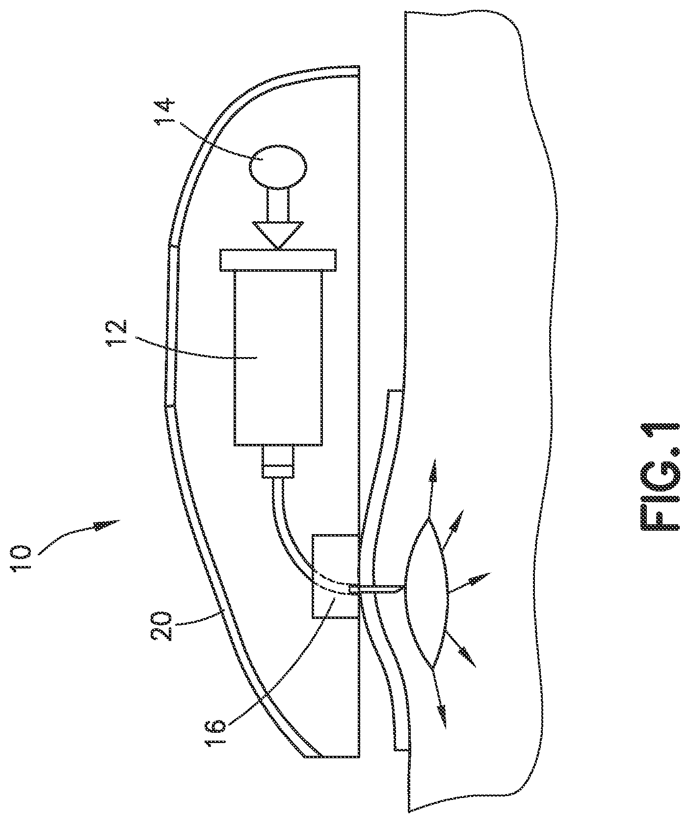 Patent US12403248 — Needle hub for drug delivery device — Figure 1