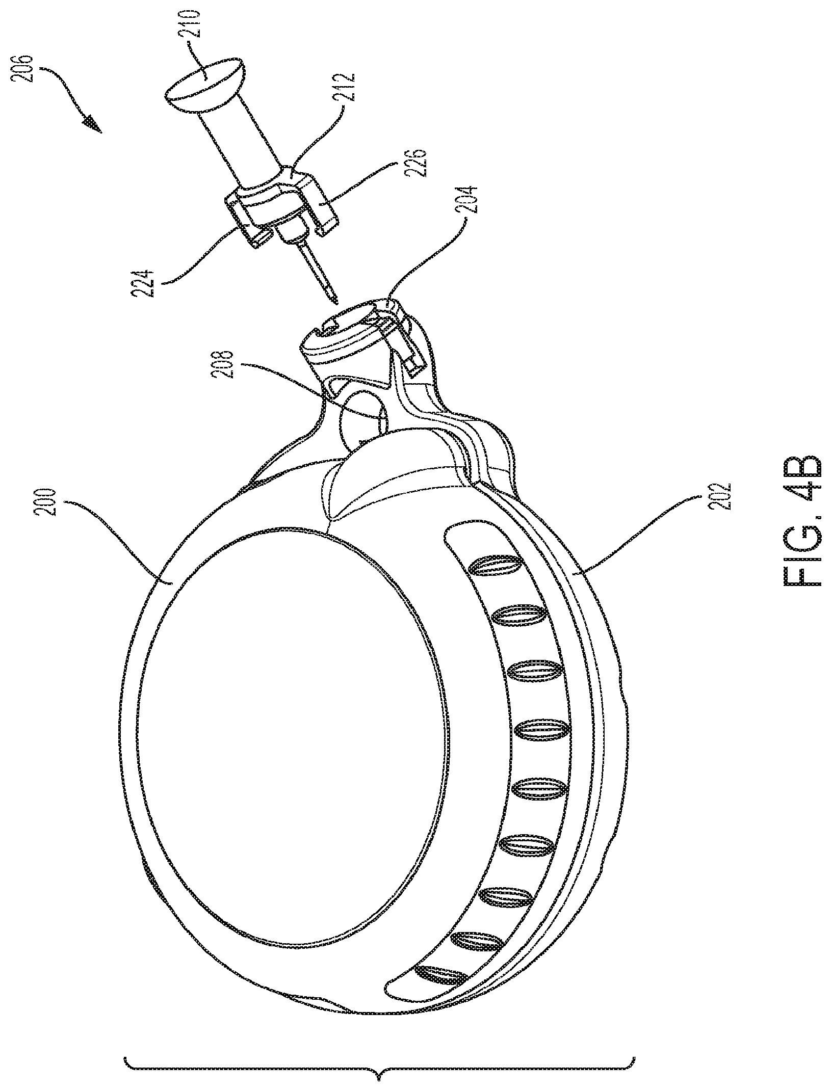 Patent US12403252 Figure 11 – Infusion device system and apparatus