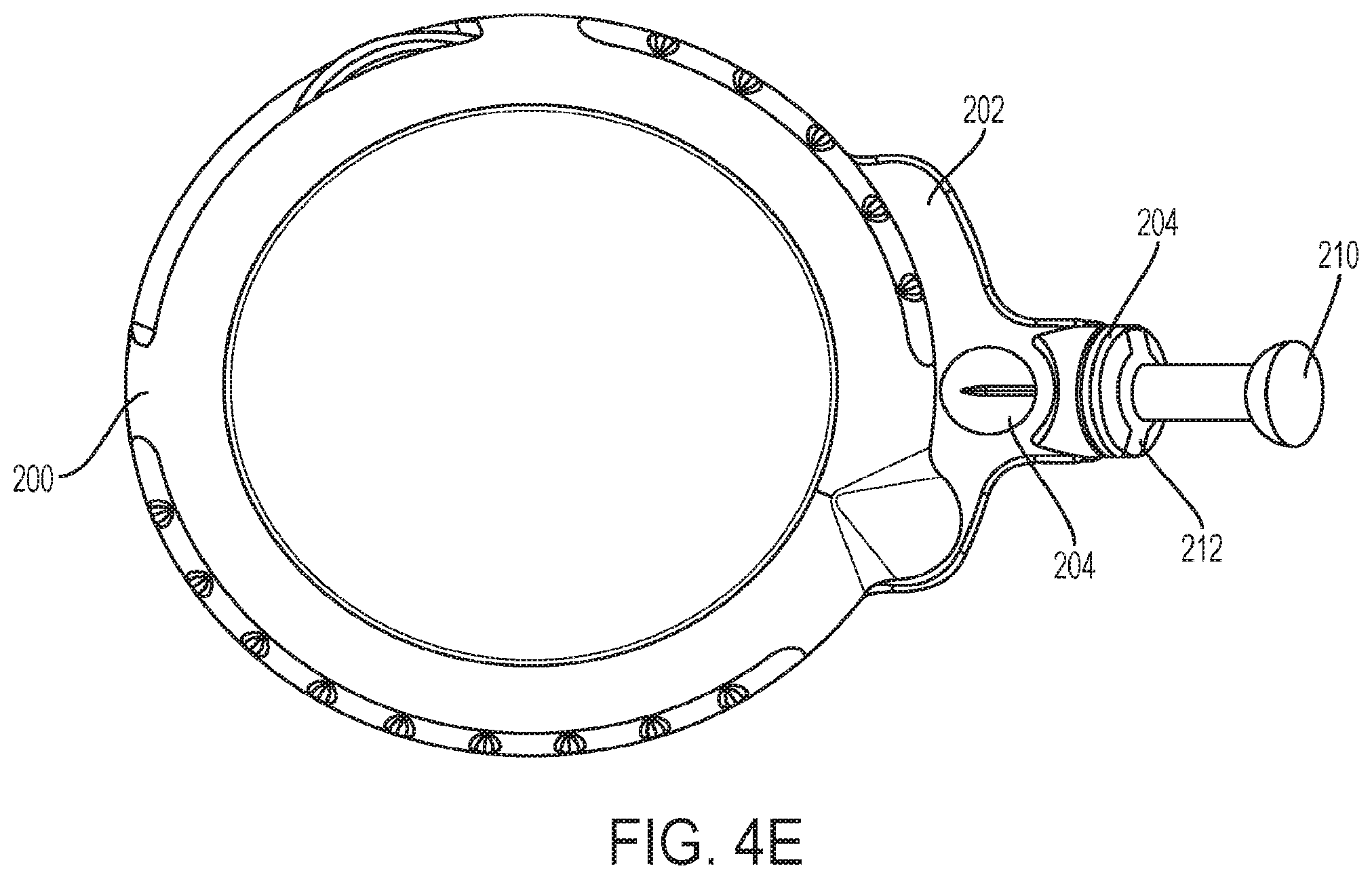 Patent US12403252 Figure 14 – Infusion device system and apparatus