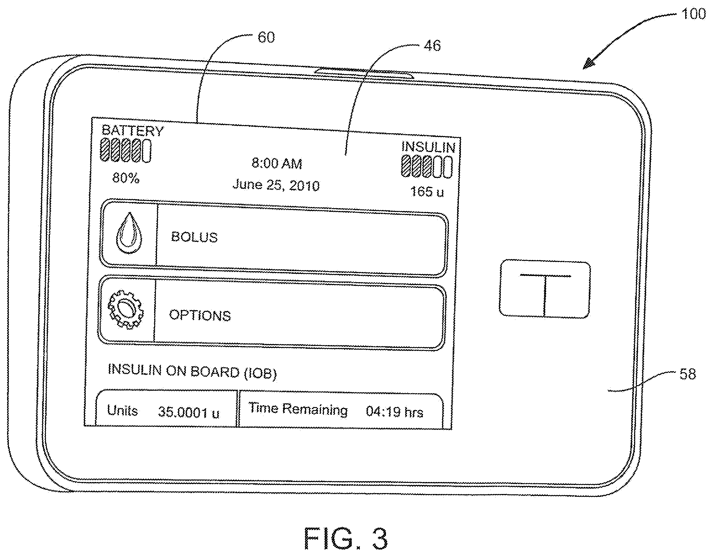 Patent US12403256 Figure 3 – Simplified insulin delivery for diabetics