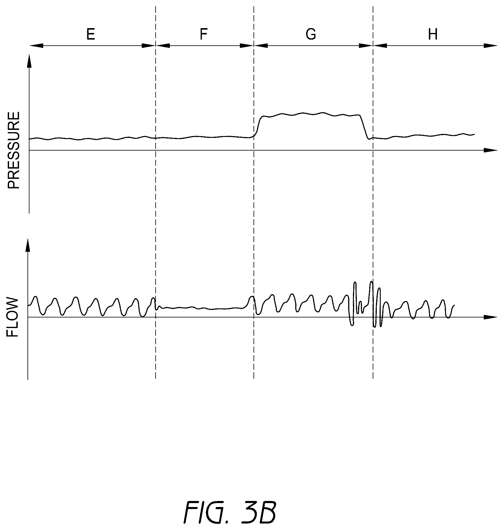 Patent US12403278 Figure 4 – Apparatus and method for providing gases to a user